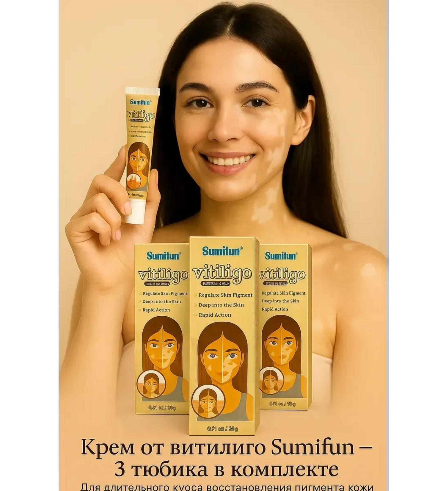 1000 little things Vitiligo cream from white skin spots 3 pcs - Buy Online on GoSupps.com