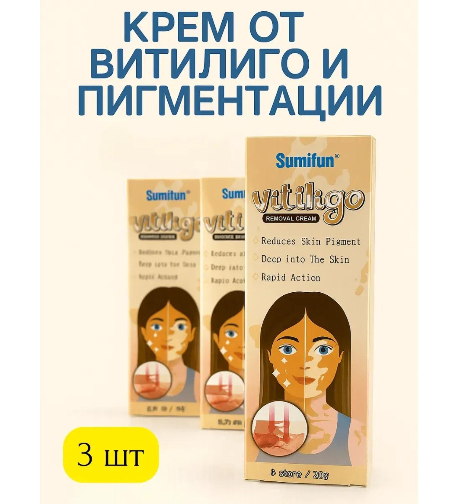 wwwmili Vitiligo cream and pigmentation - Buy Online on GoSupps.com
