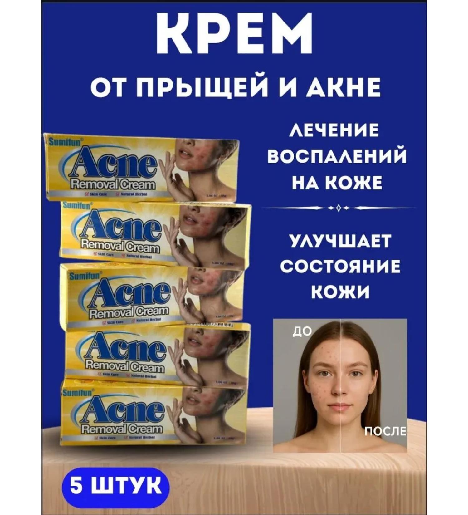 NT83 Acne cream and acne on the skin - Buy Online on GoSupps.com