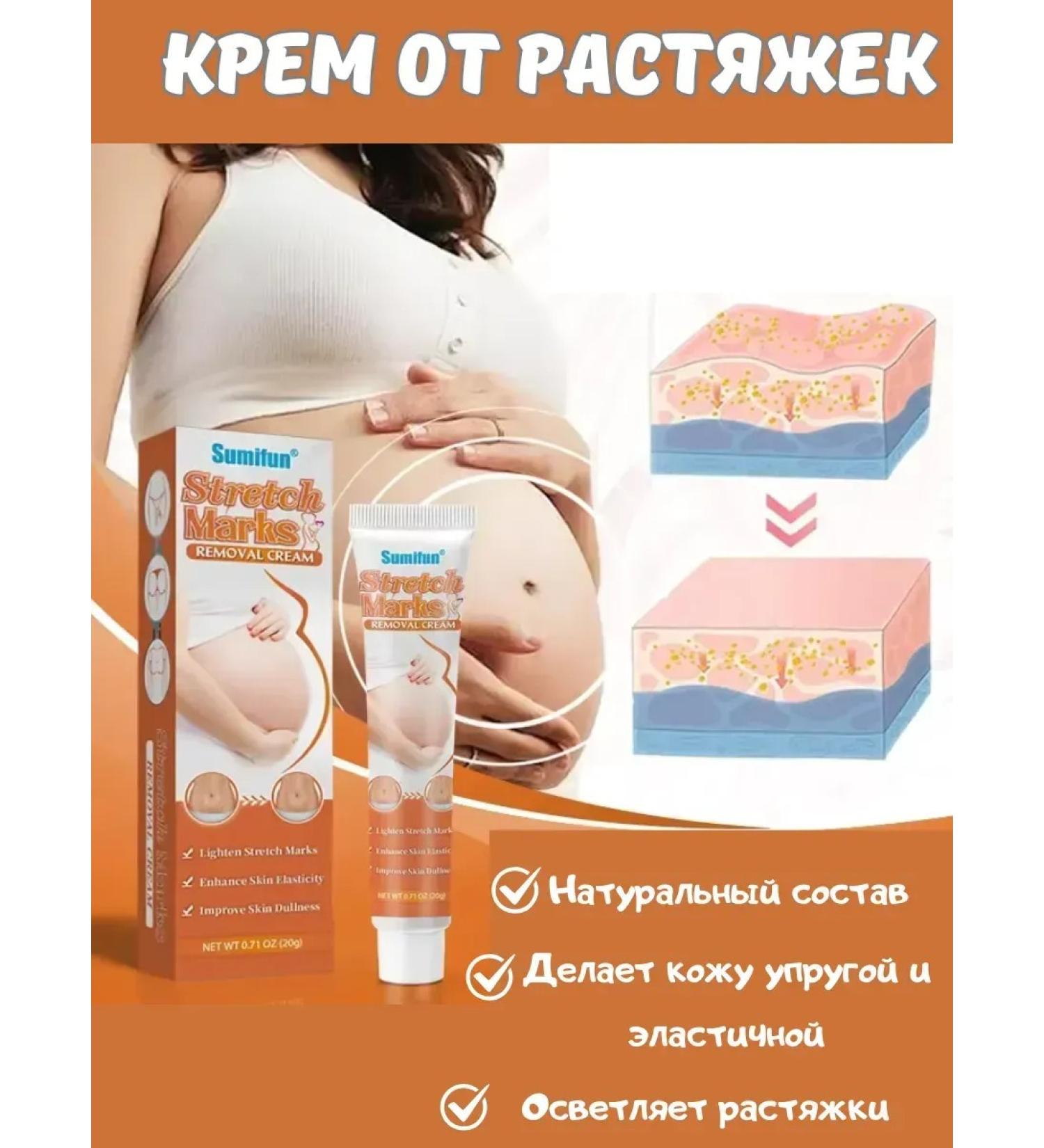 AlexaMM Pregnant stretch marks - Buy Online on GoSupps.com