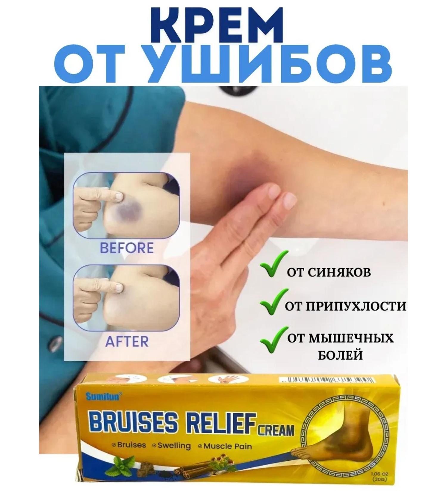 Zhodik2 Cream from bruises and bruises - Buy Online on GoSupps.com