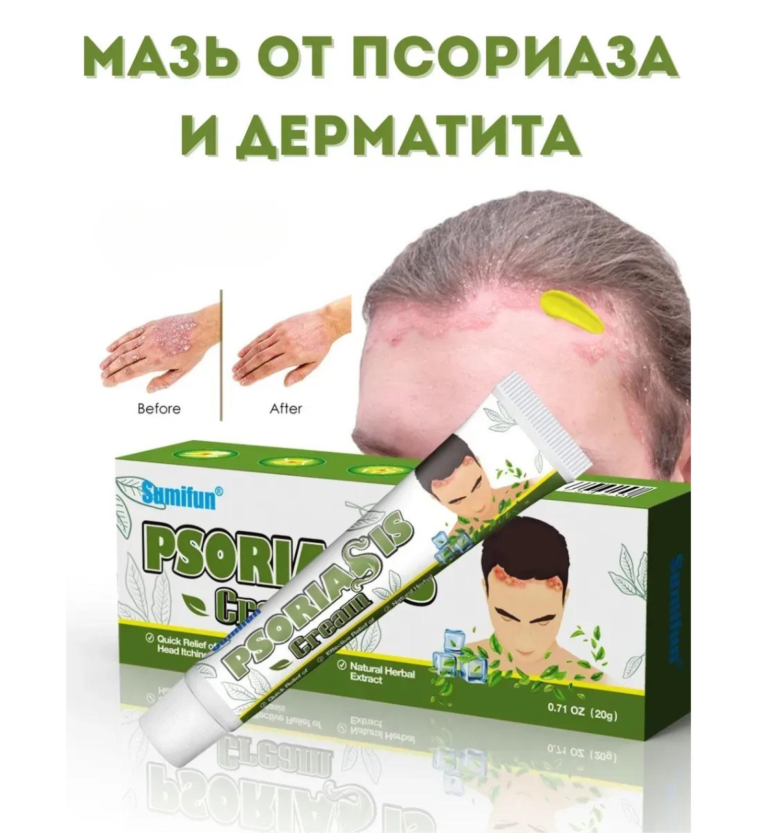 Remini Cream ointment from psoriasis and dermatitis - Buy Online on GoSupps.com