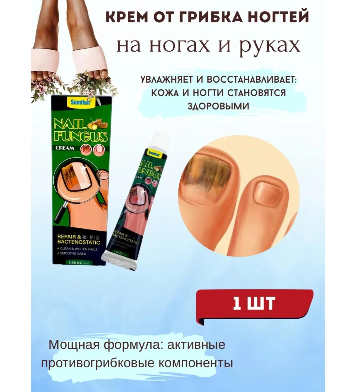 MILES 25 fungus cream on the legs and arms - Buy Online on GoSupps.com