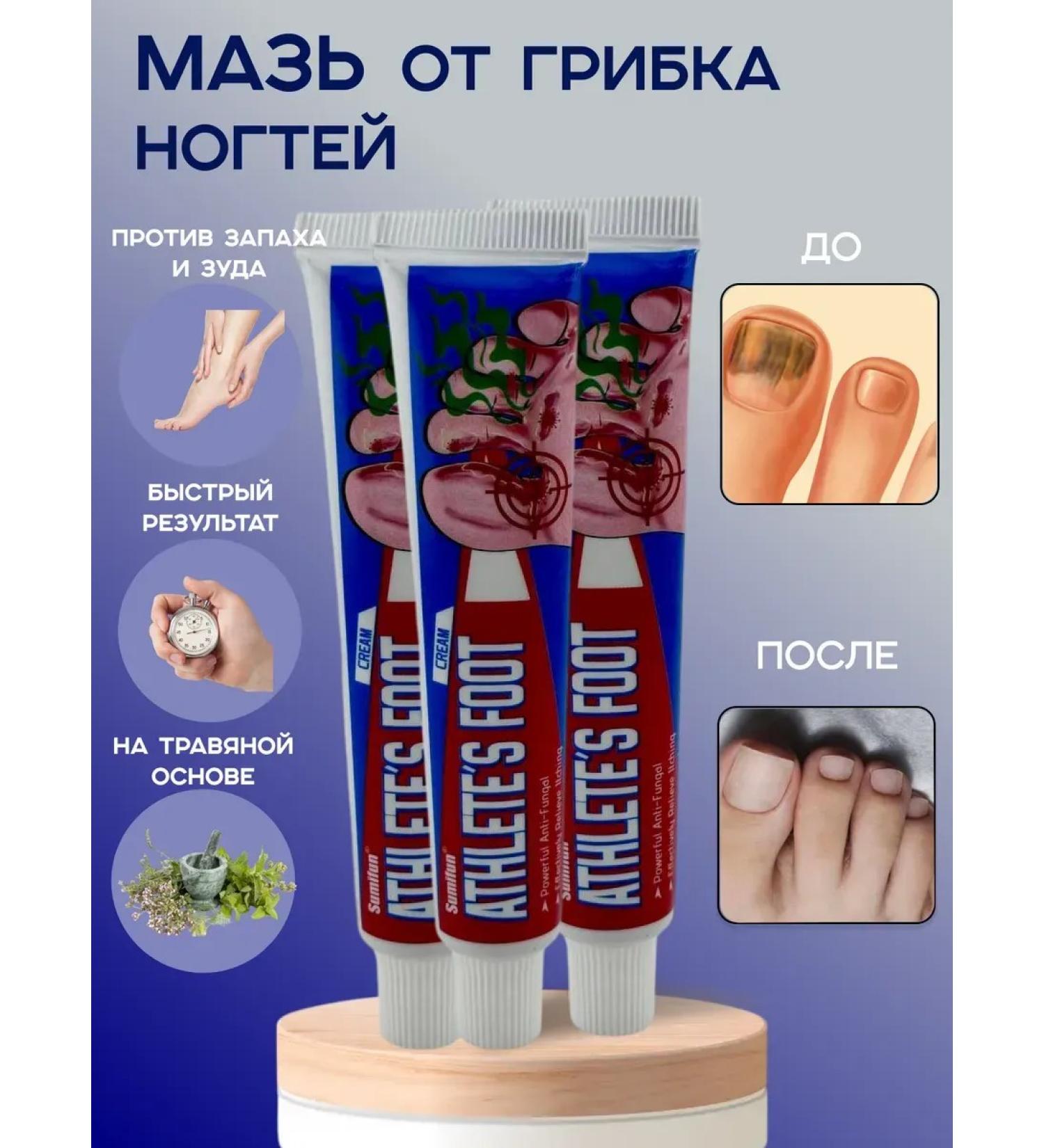 AilunaI 3pc ointment from nail fungus and smell of the legs - Buy Online on GoSupps.com