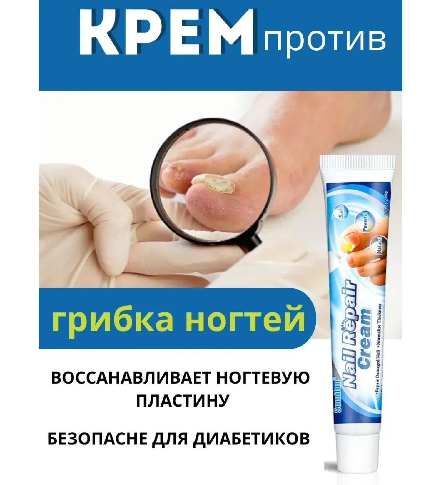 BIRKAZHY Cream against nail fungus treatment - Buy Online on GoSupps.com