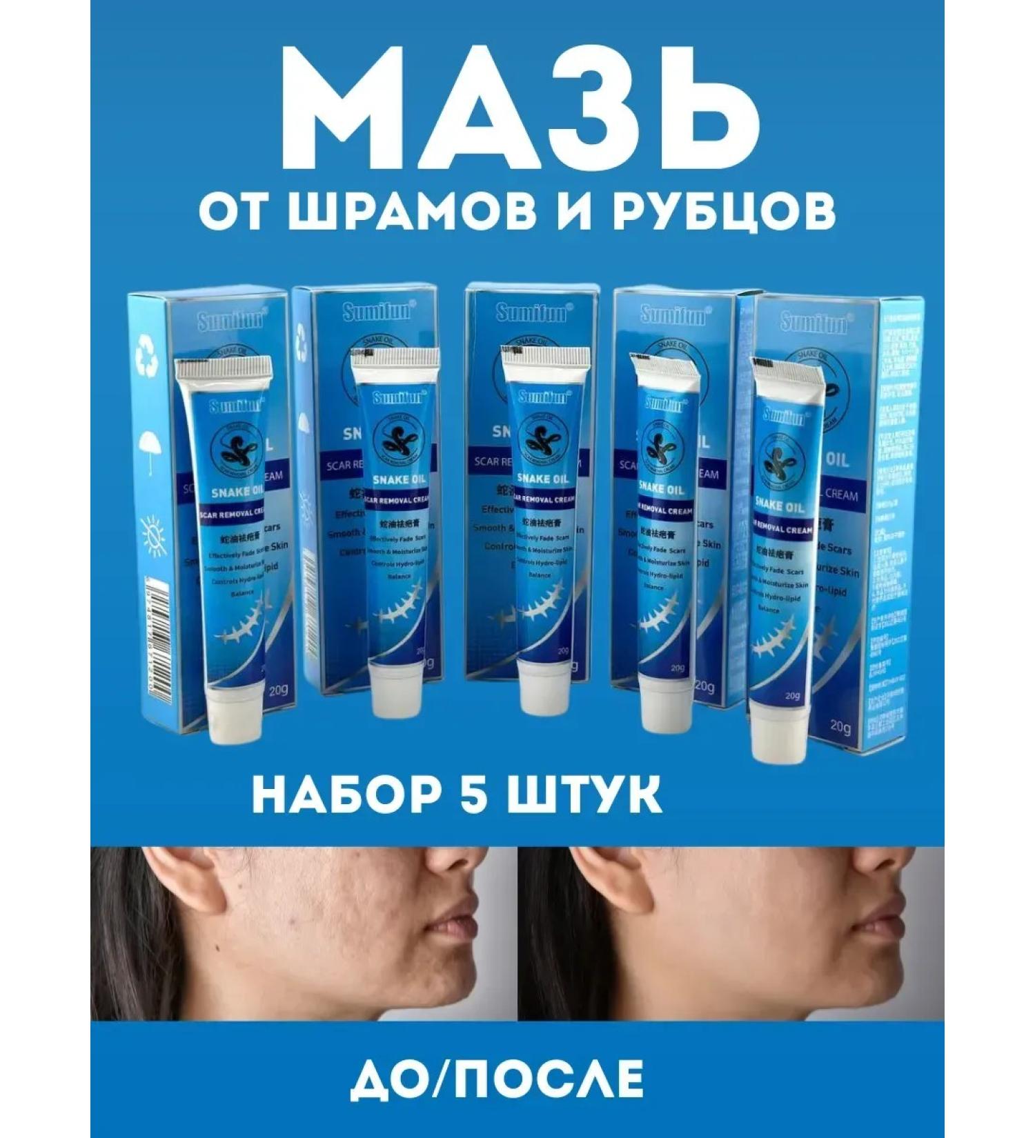 NUNA1 cream for removing scars and scars - Buy Online on GoSupps.com