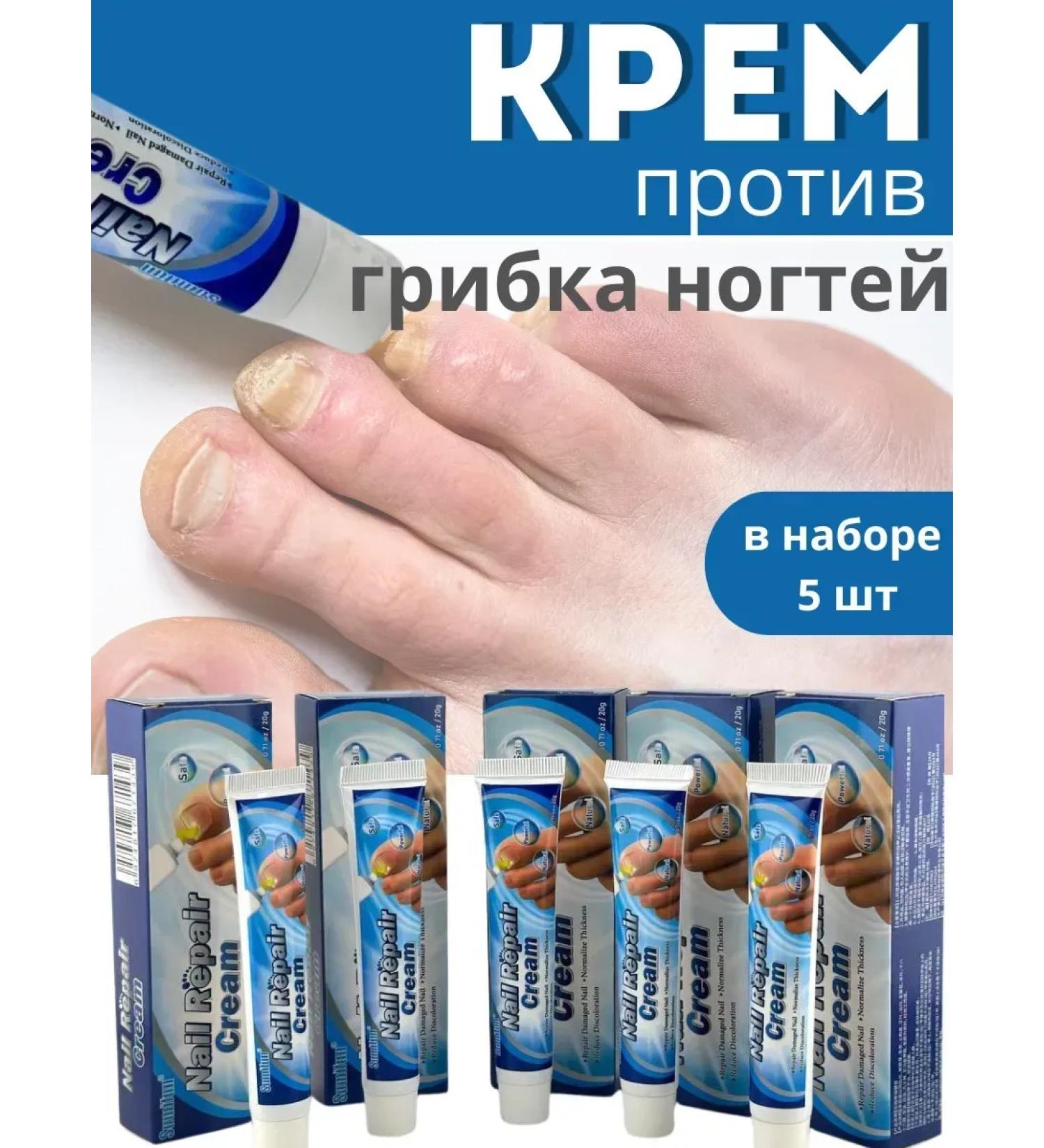 BIRKAZHY Cream against nail fungi 5pcs - Buy Online on GoSupps.com