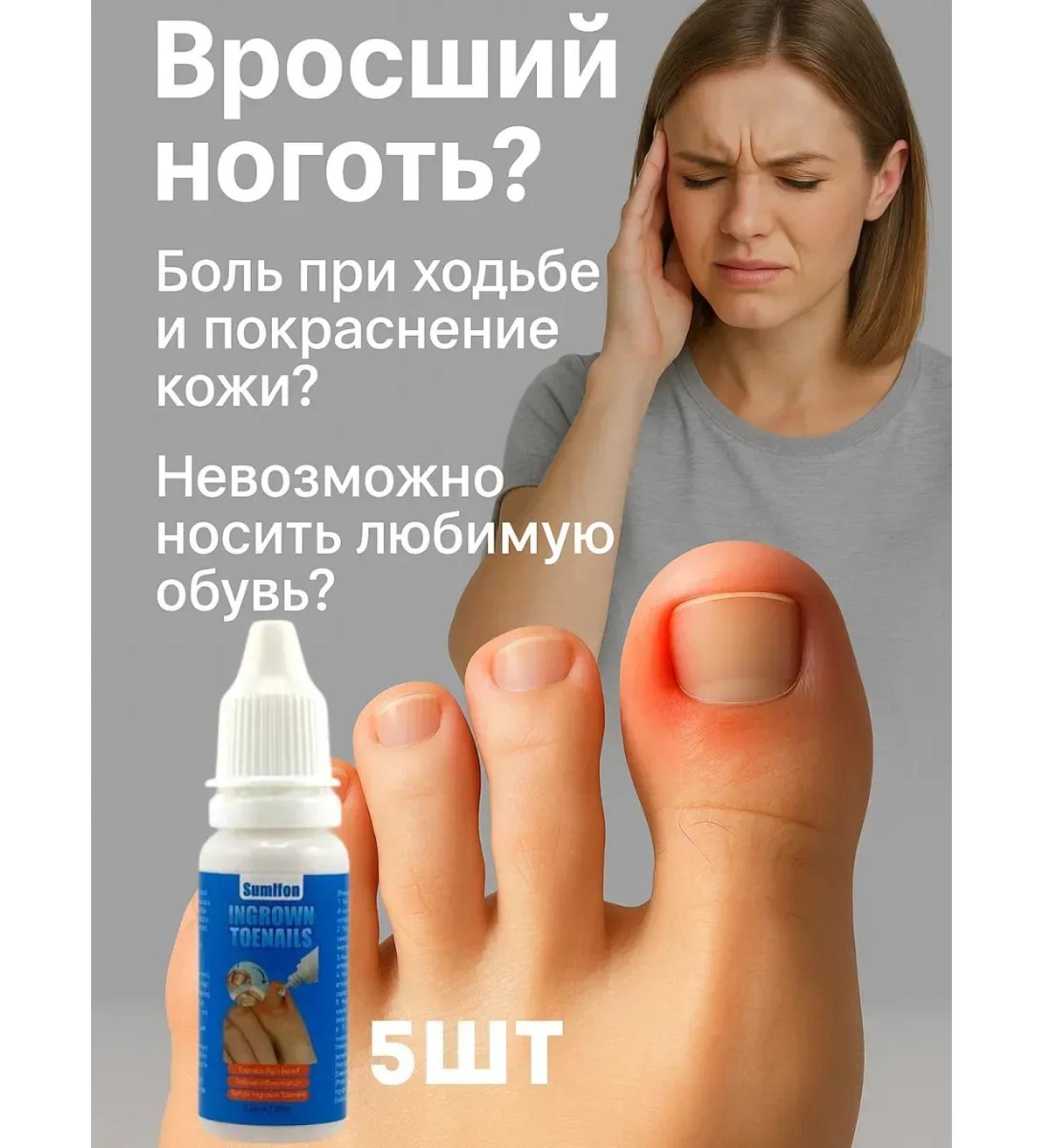 DDE intensive A remedy for an ingrown nail 5pcs - Buy Online on GoSupps.com