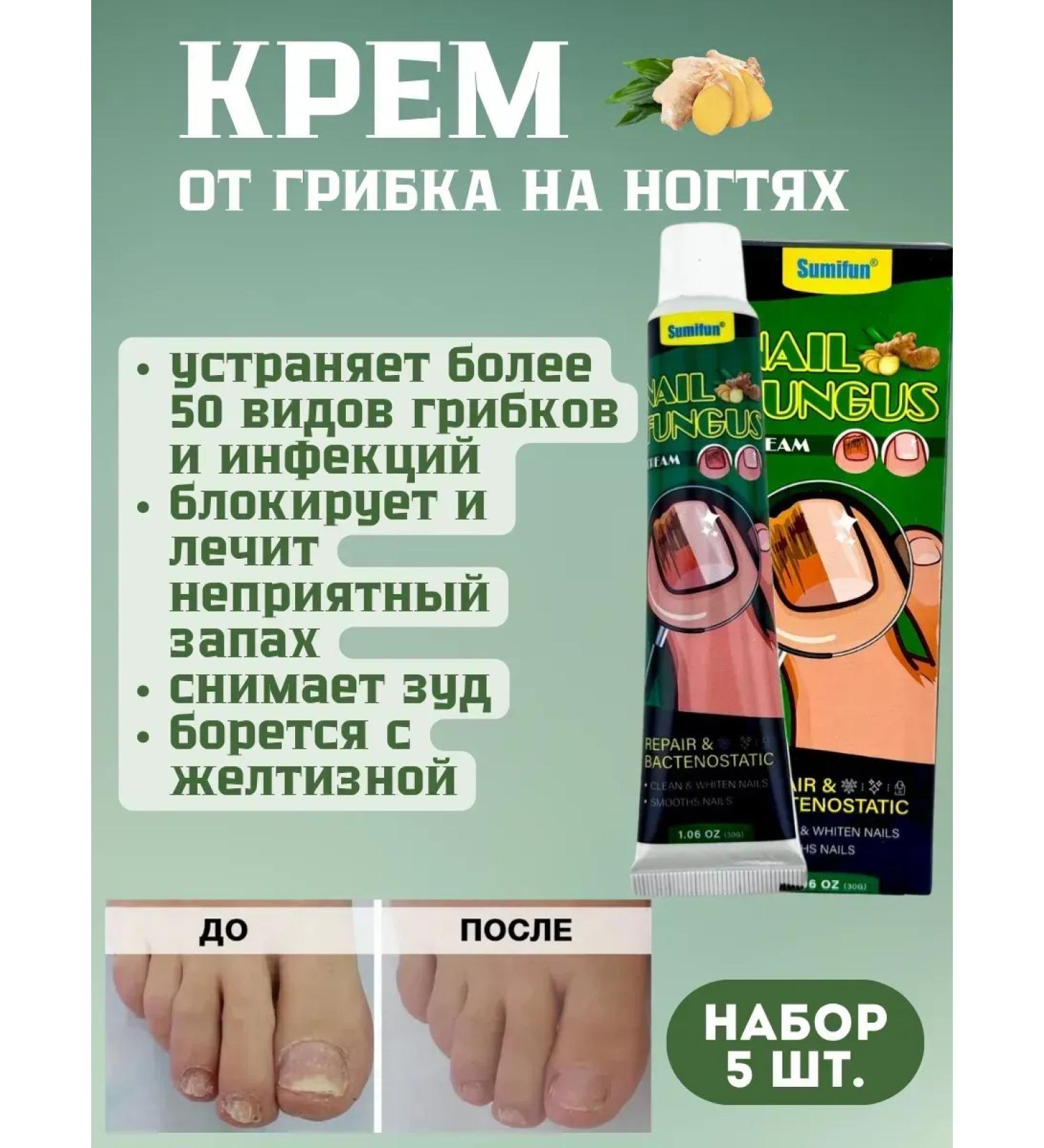 AYPOSH Set of fungus cream on nails 5 pcs - Buy Online on GoSupps.com