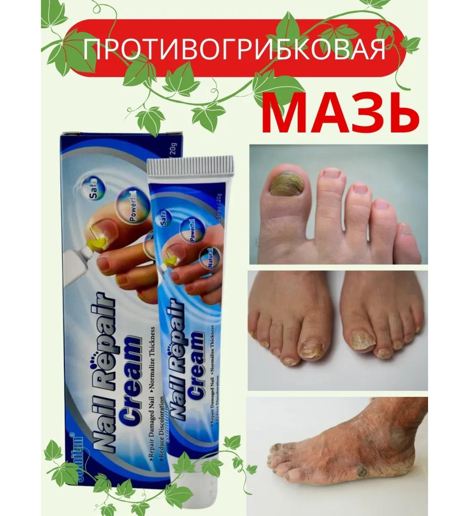 KEVO Cream against the nail fungus smell of the legs from candida - Buy Online on GoSupps.com