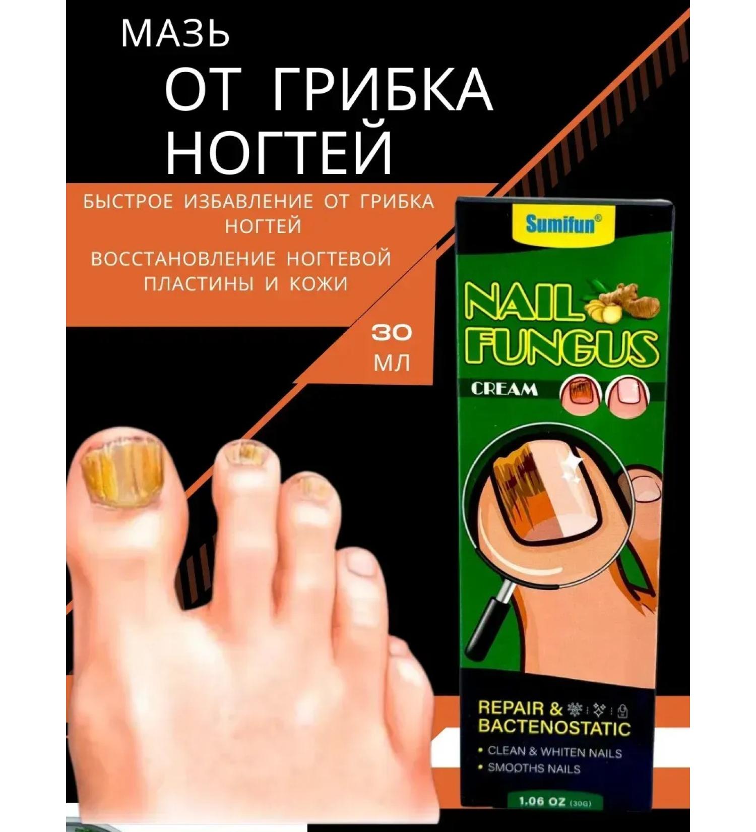 Ointment from the fungus of nails on the legs therapeutic. China - Buy Online on GoSupps.com