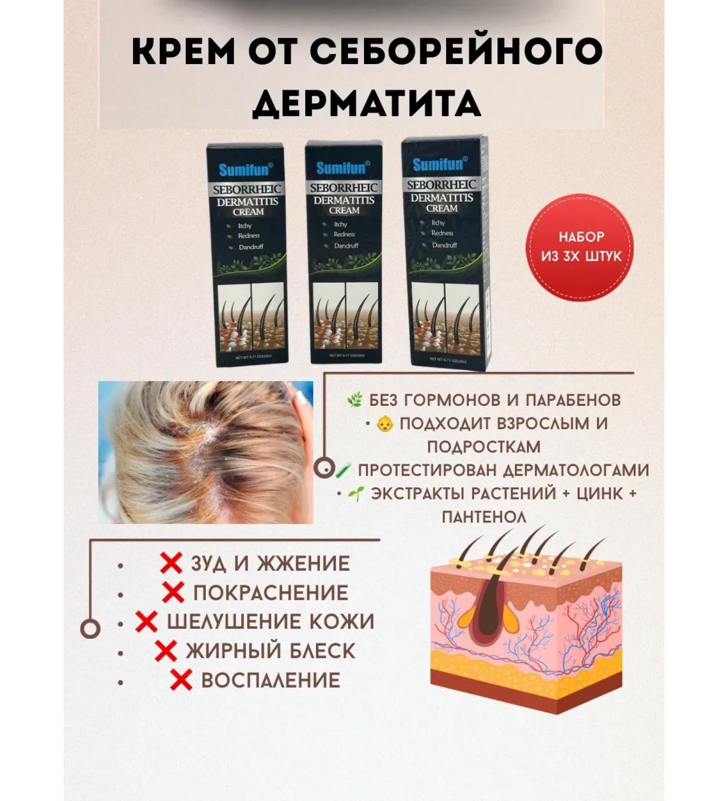 MILES 25 Cream from seborrheic dermatitis - Buy Online on GoSupps.com