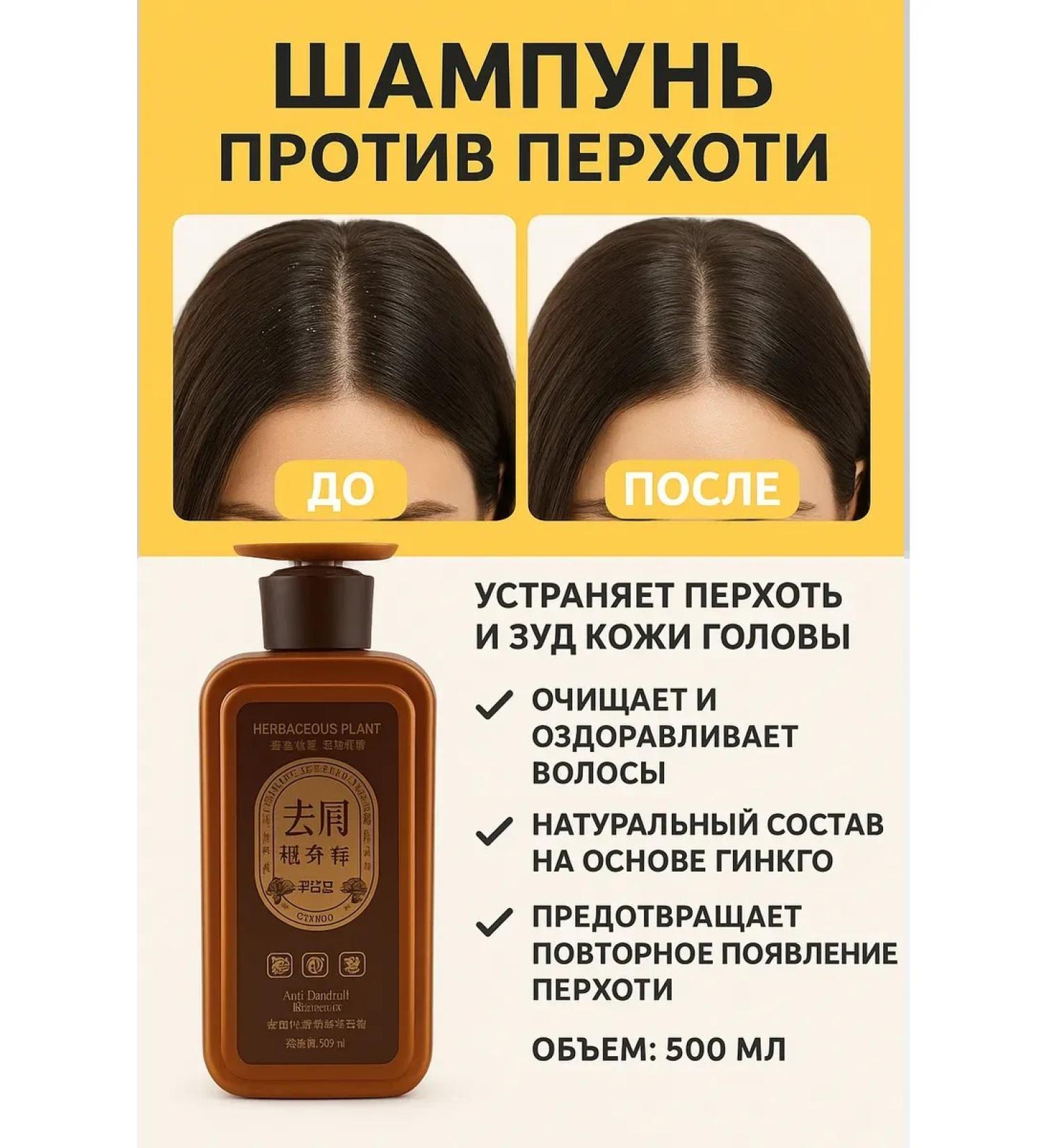 Usya Chinese shampoo against dandruff 500 ml - Buy Online on GoSupps.com