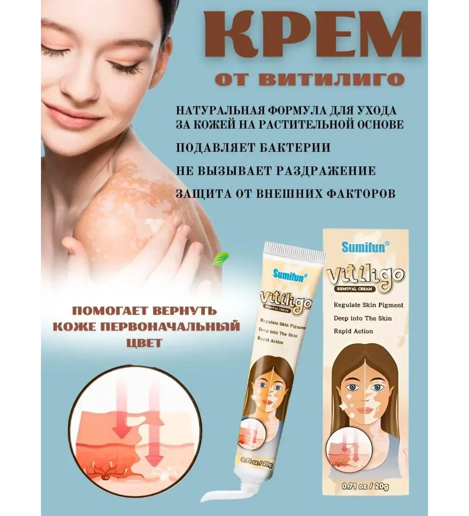 VALLEY Vitiligo cream from pigmented white stains of the skin - Buy Online on GoSupps.com