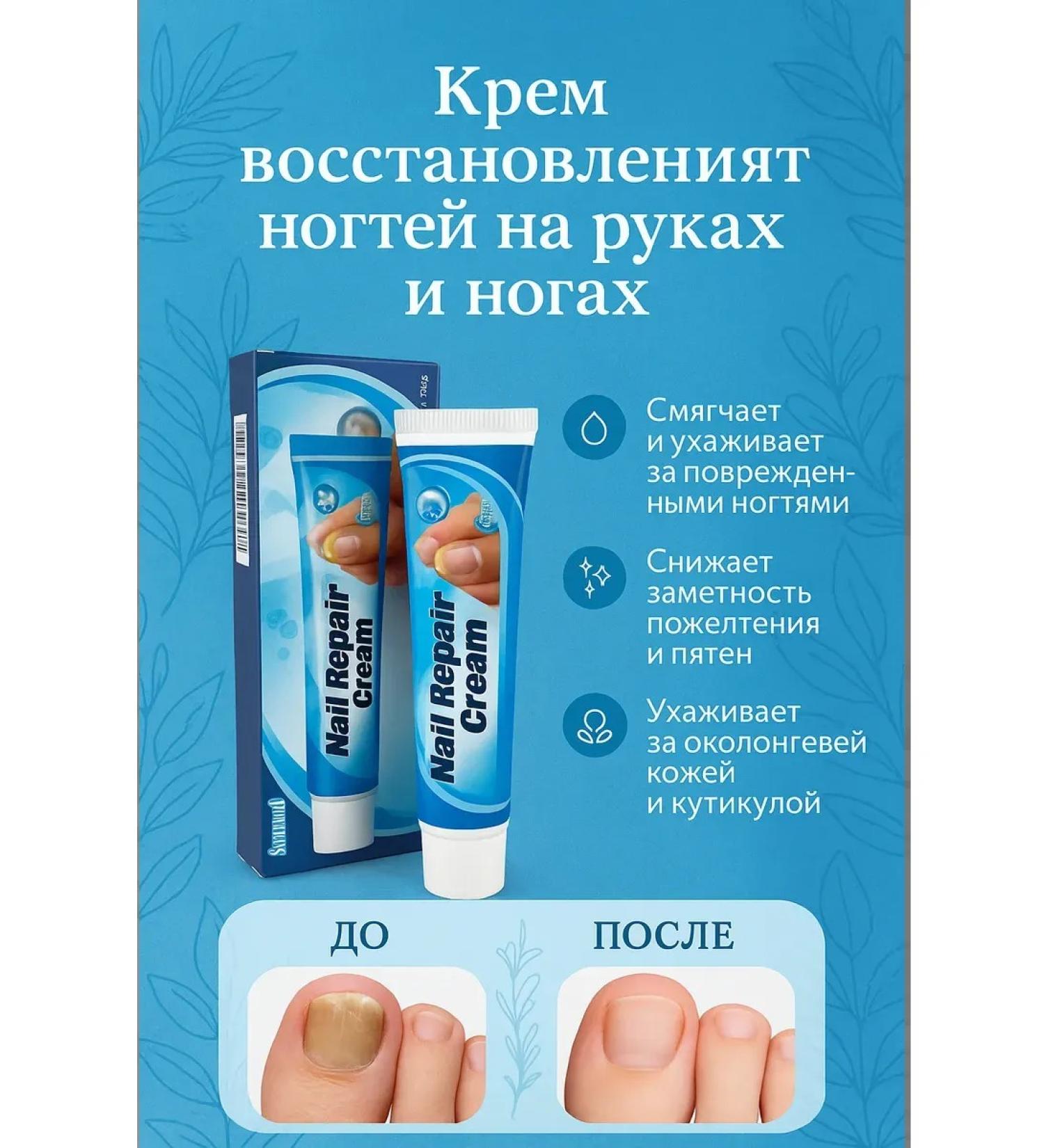 Kubataeva Antigritor nail cream on the legs and arms - Buy Online on GoSupps.com