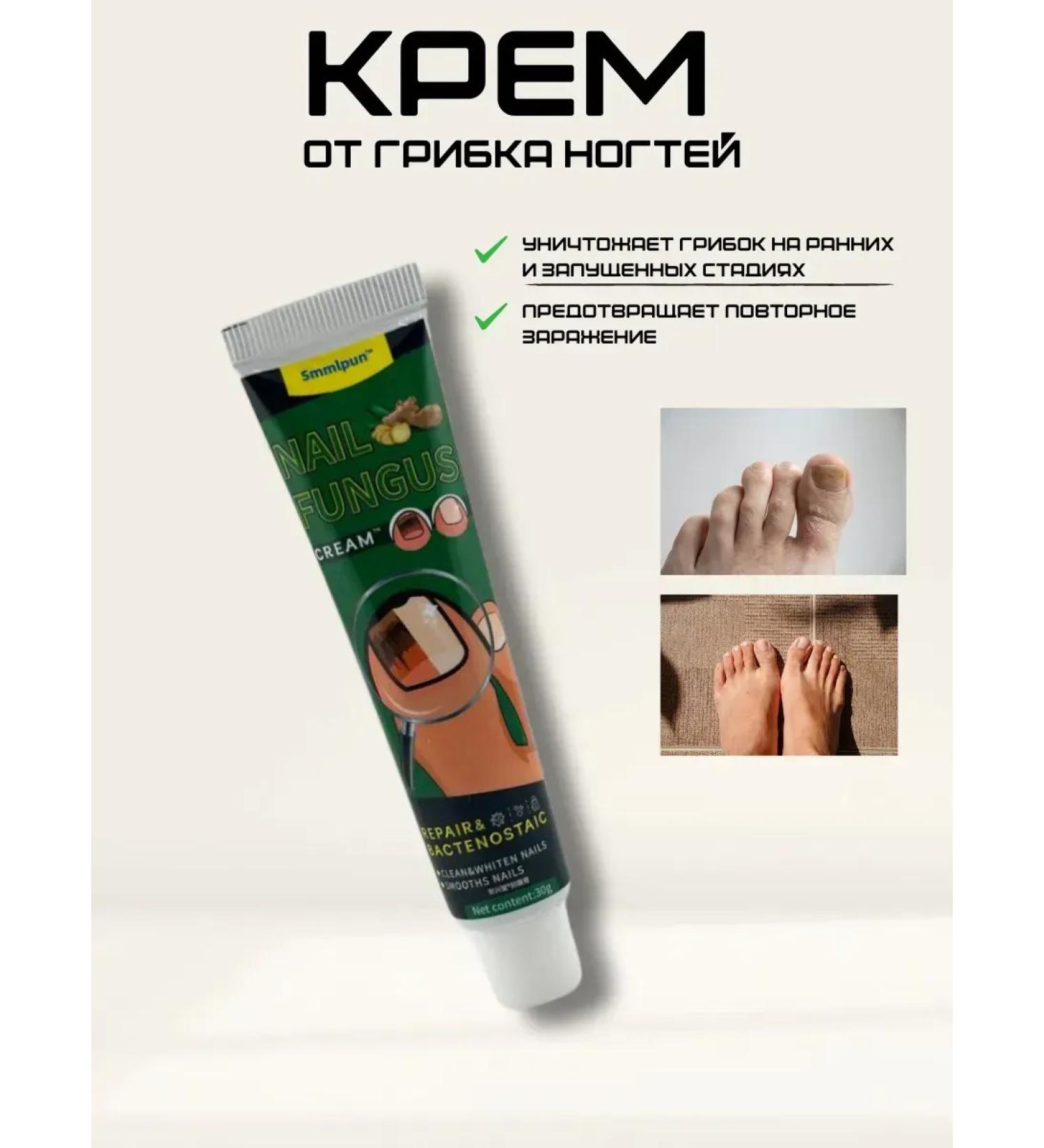 DDE intensive Nail fungus cream - Buy Online on GoSupps.com