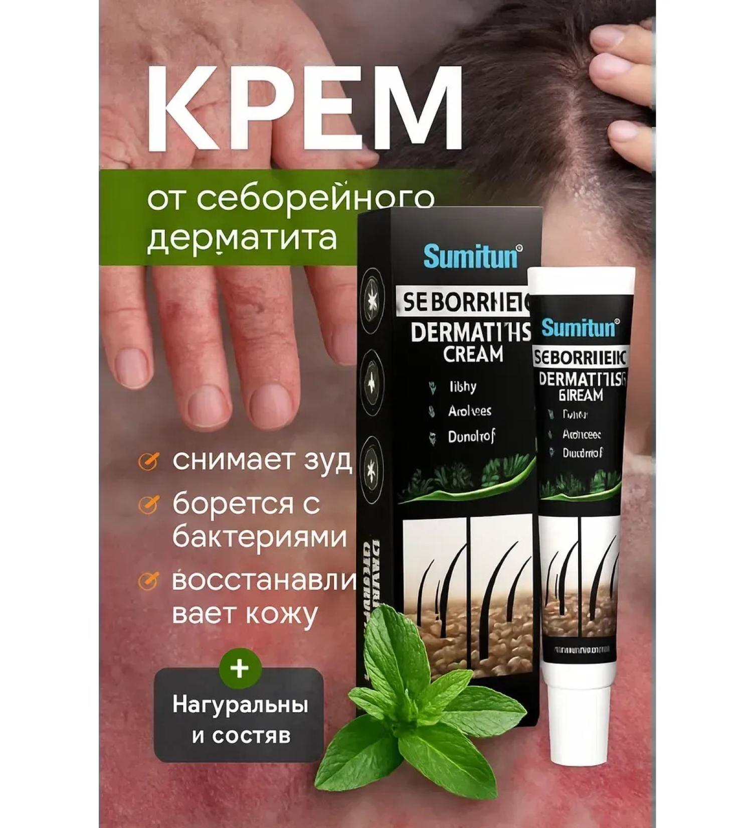 Luck Chinese cream from psoriasis dermatitis - Buy Online on GoSupps.com