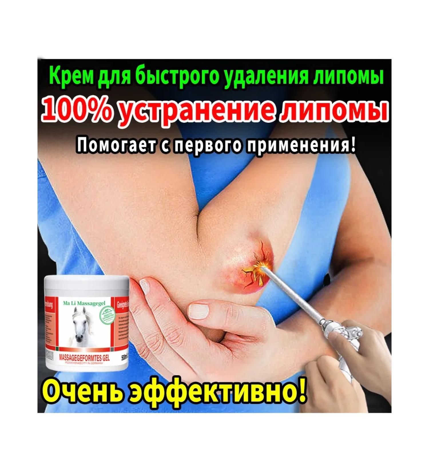 Ointment from Lipoma and Giroviks - Buy Online on GoSupps.com