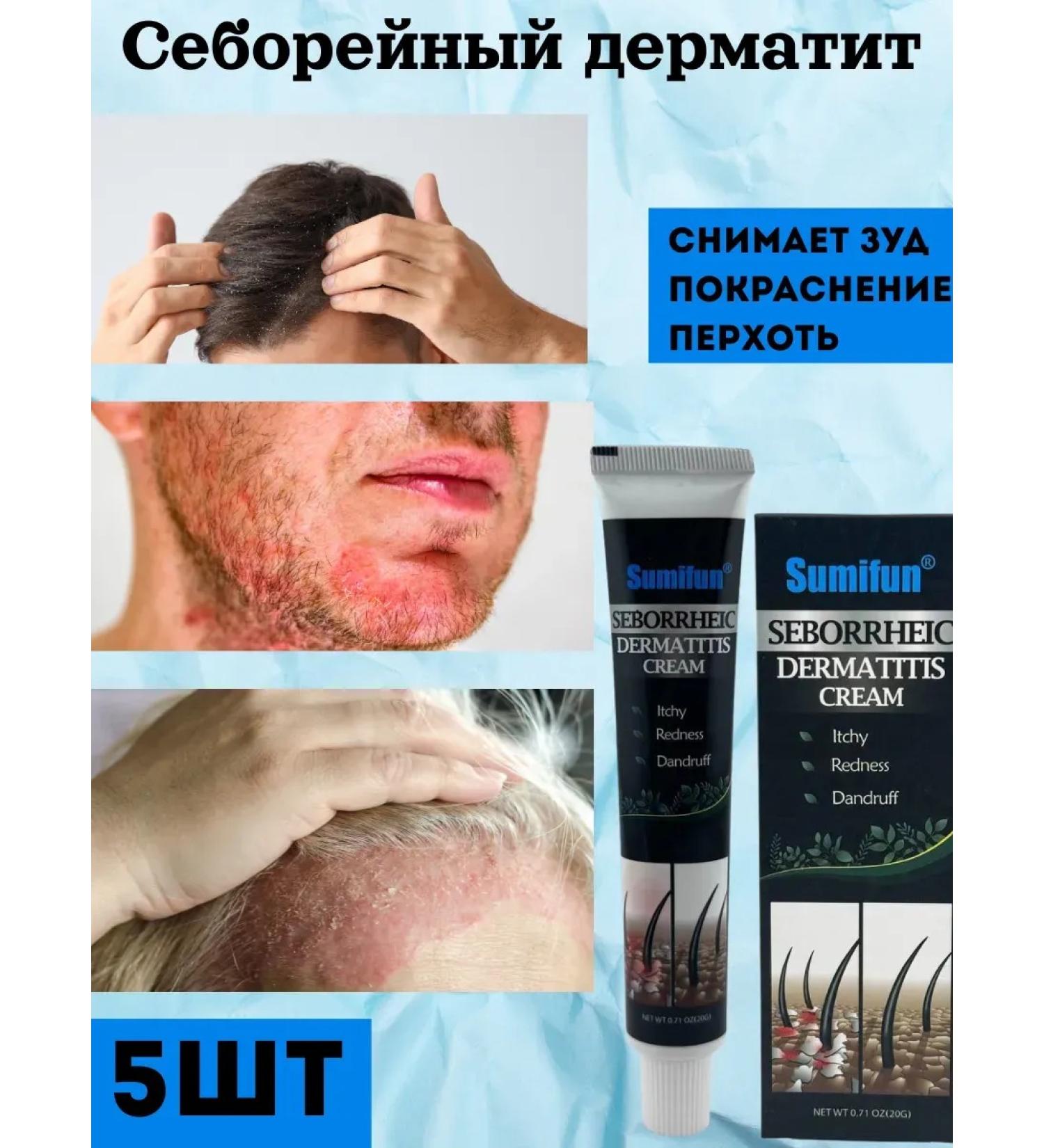 mali21 Cream from seborrheic dermatitis - Buy Online on GoSupps.com