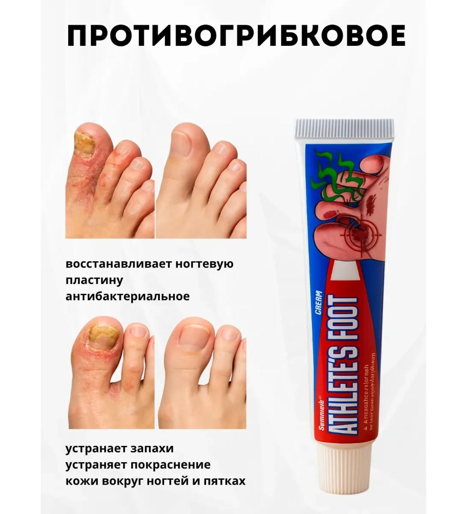 mua Ointment from nail fungus on the legs and between the fingers and the skin - Buy Online on GoSupps.com