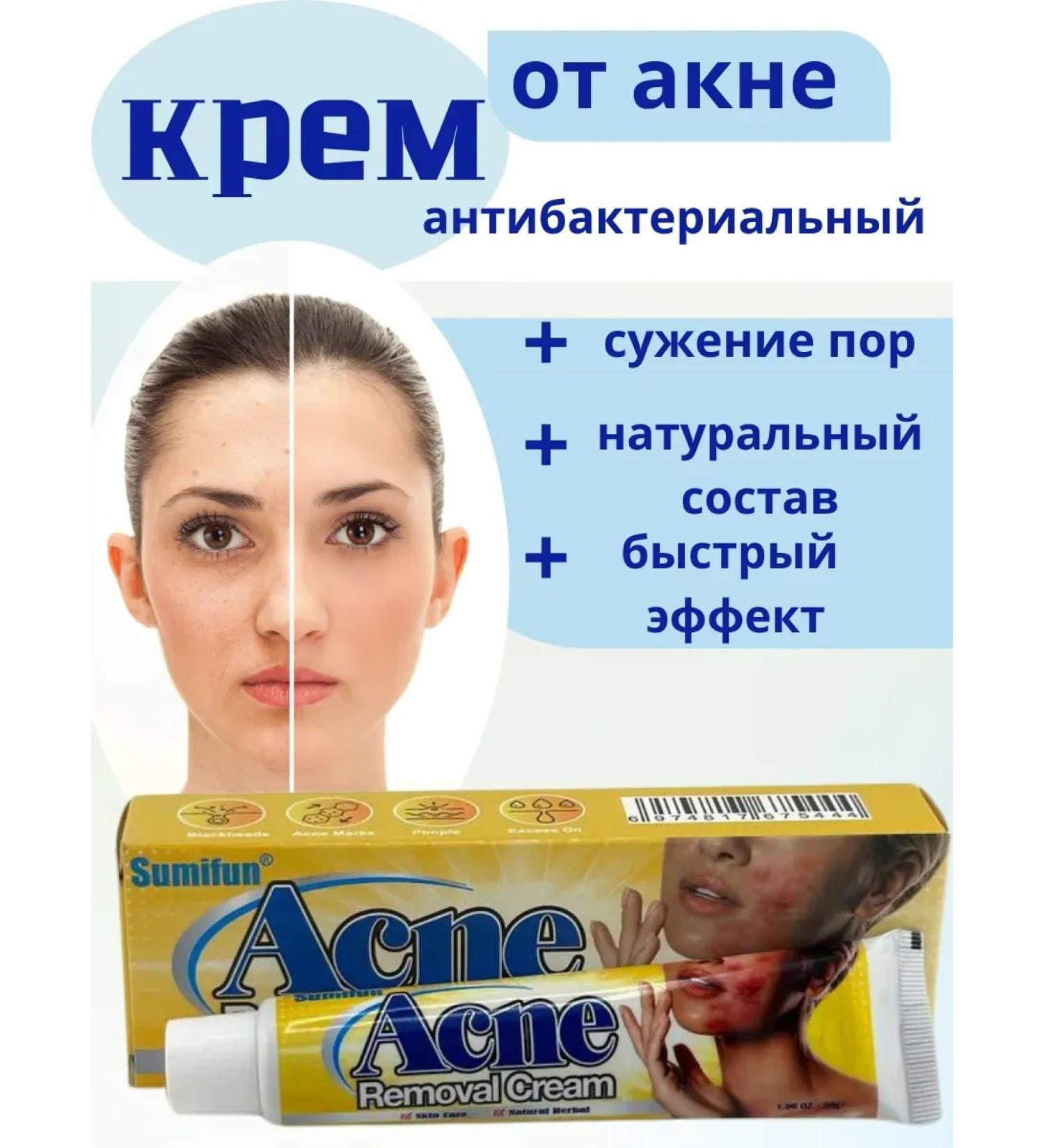 alma2 Acne cream of acne antibacterial - Buy Online on GoSupps.com