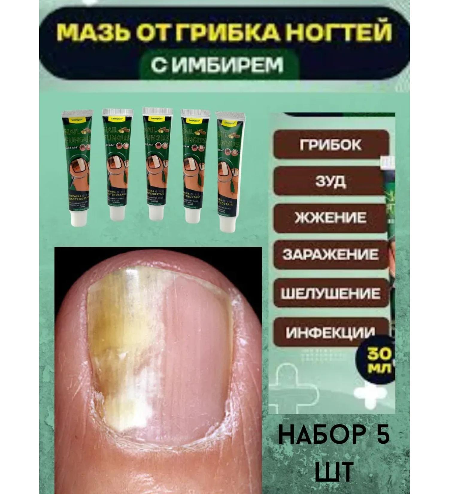 Leila ointment for nail fungus