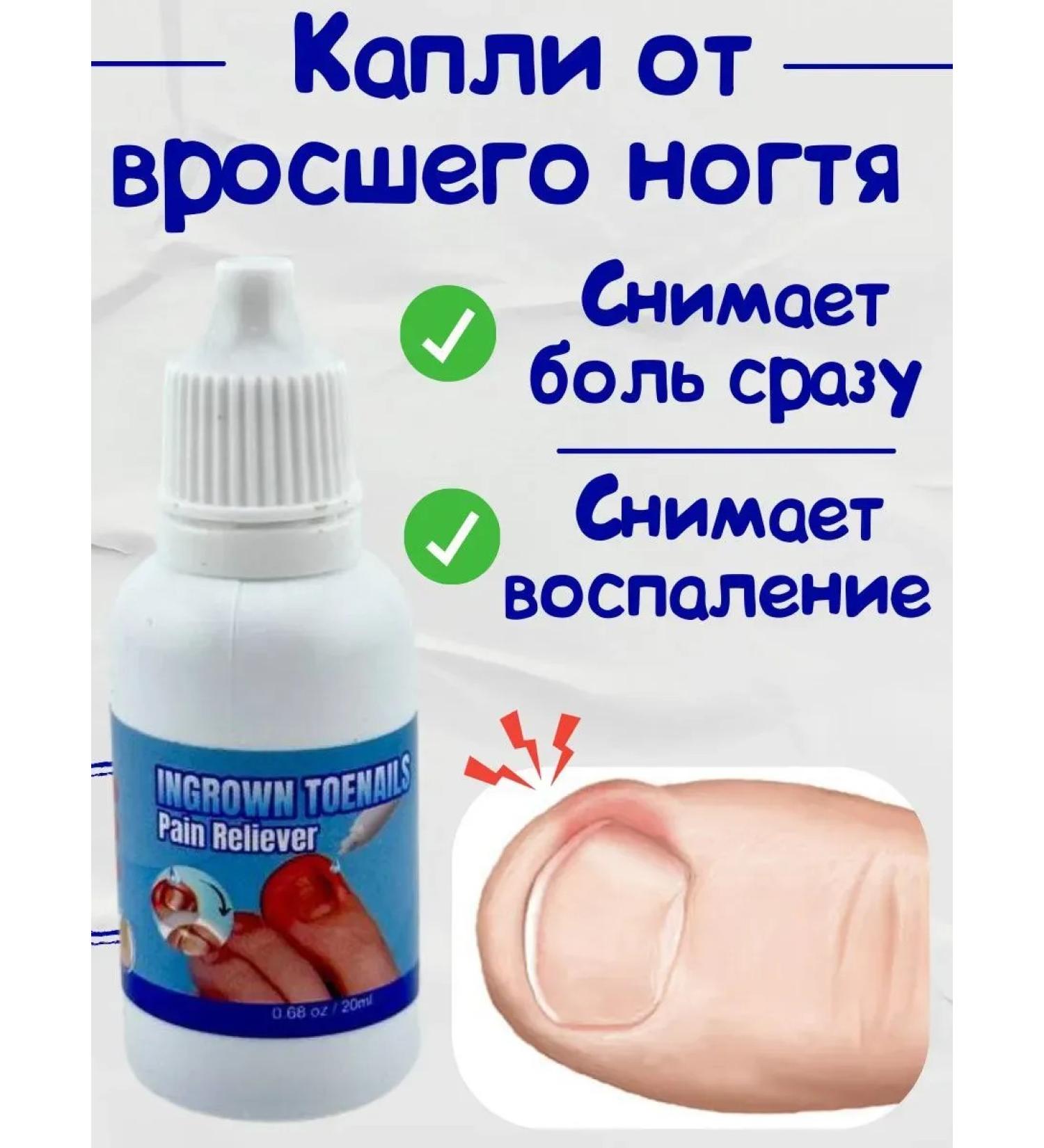 NT83 Drops from an ingrown nail on the legs - Buy Online on GoSupps.com