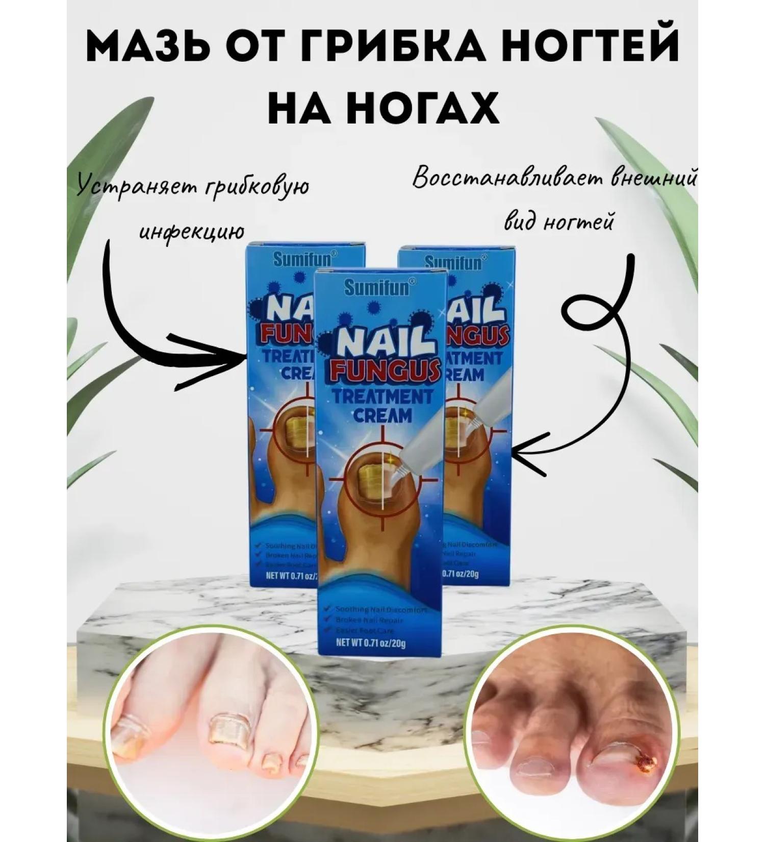 Kalis Ointment from nail fungus on the legs 3pcs - Buy Online on GoSupps.com