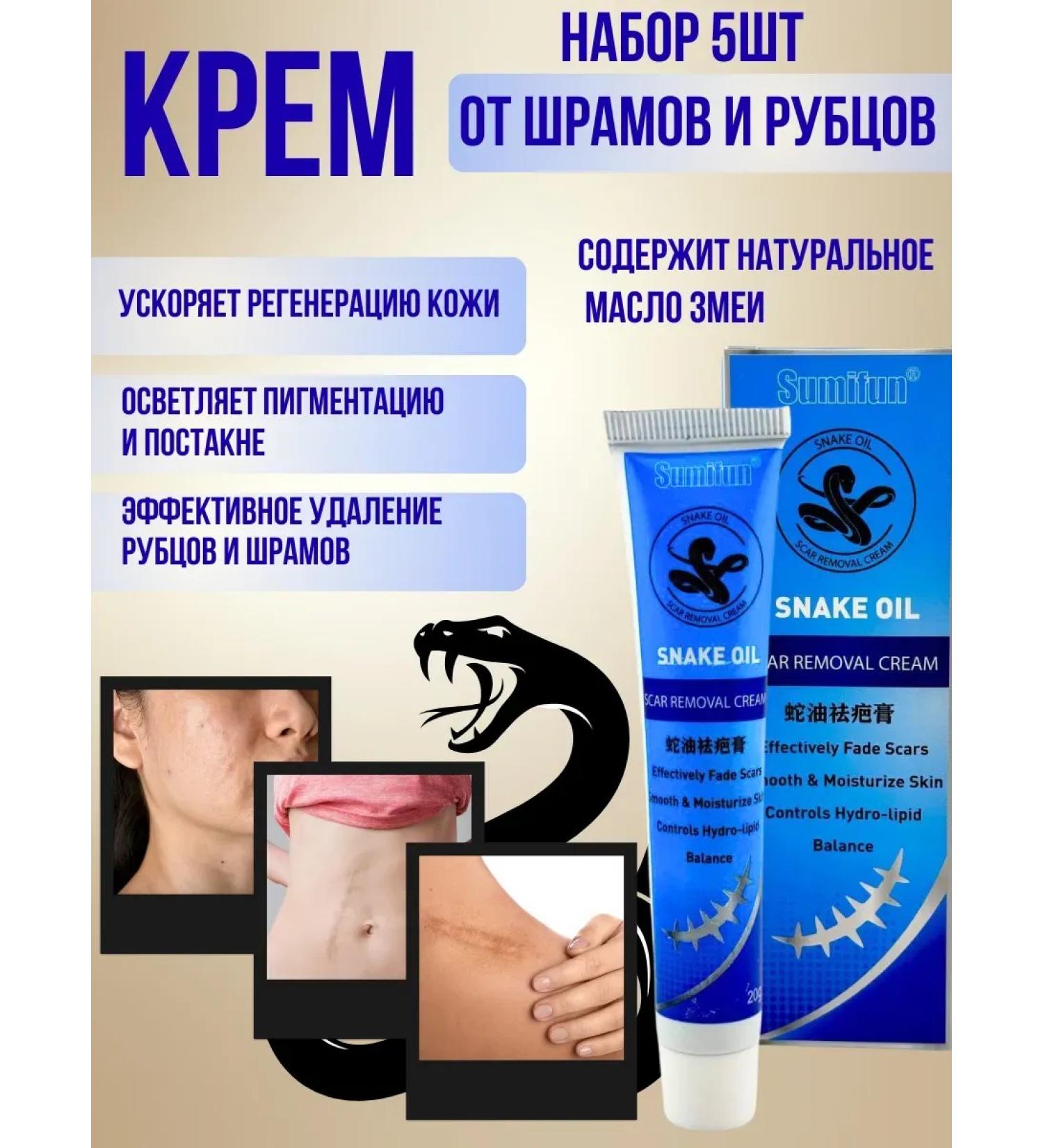 Alma cream from scars and burns skin restoration 5pcs - Buy Online on GoSupps.com