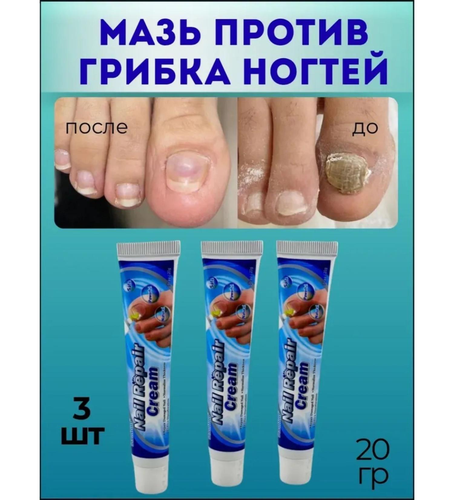 NT83 Ointment against the fungus on nails set 3pcs - Buy Online on GoSupps.com