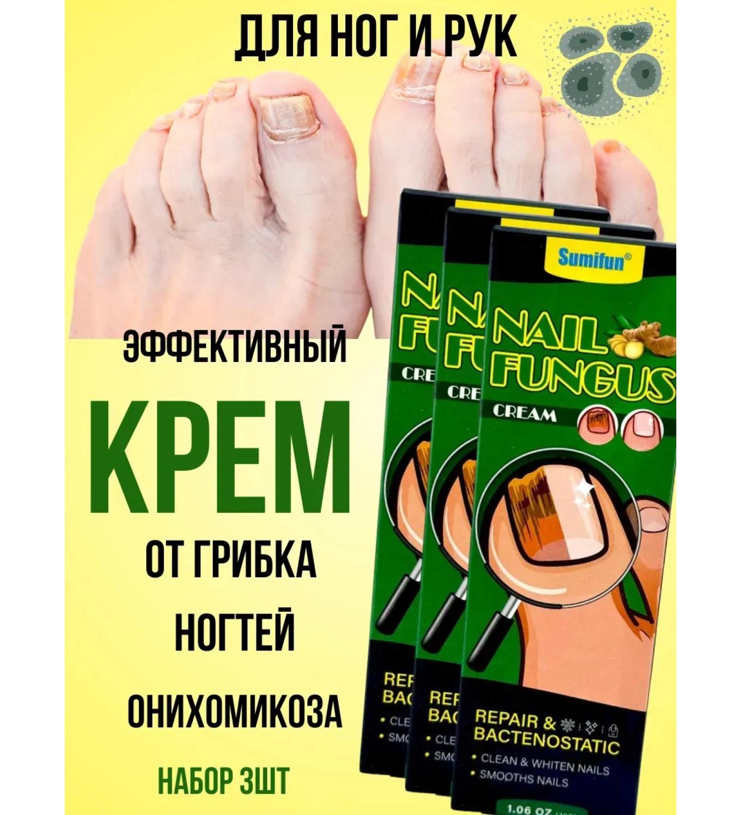 alma2 antifungal cream for nails for arms and legs 3pcs - Buy Online on GoSupps.com