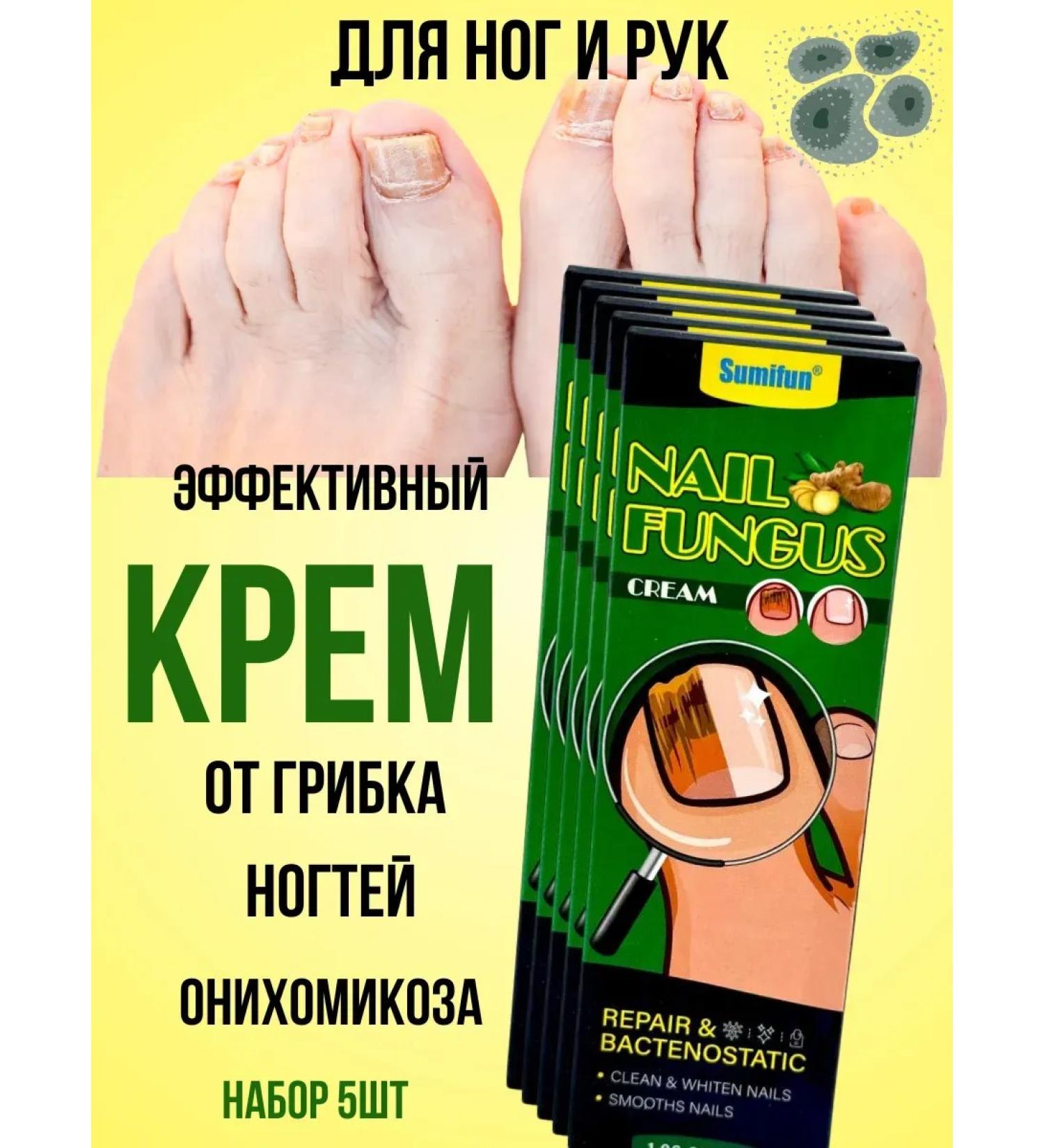 alma2 antifungal cream for nails and legs effective 5pcs - Buy Online on GoSupps.com