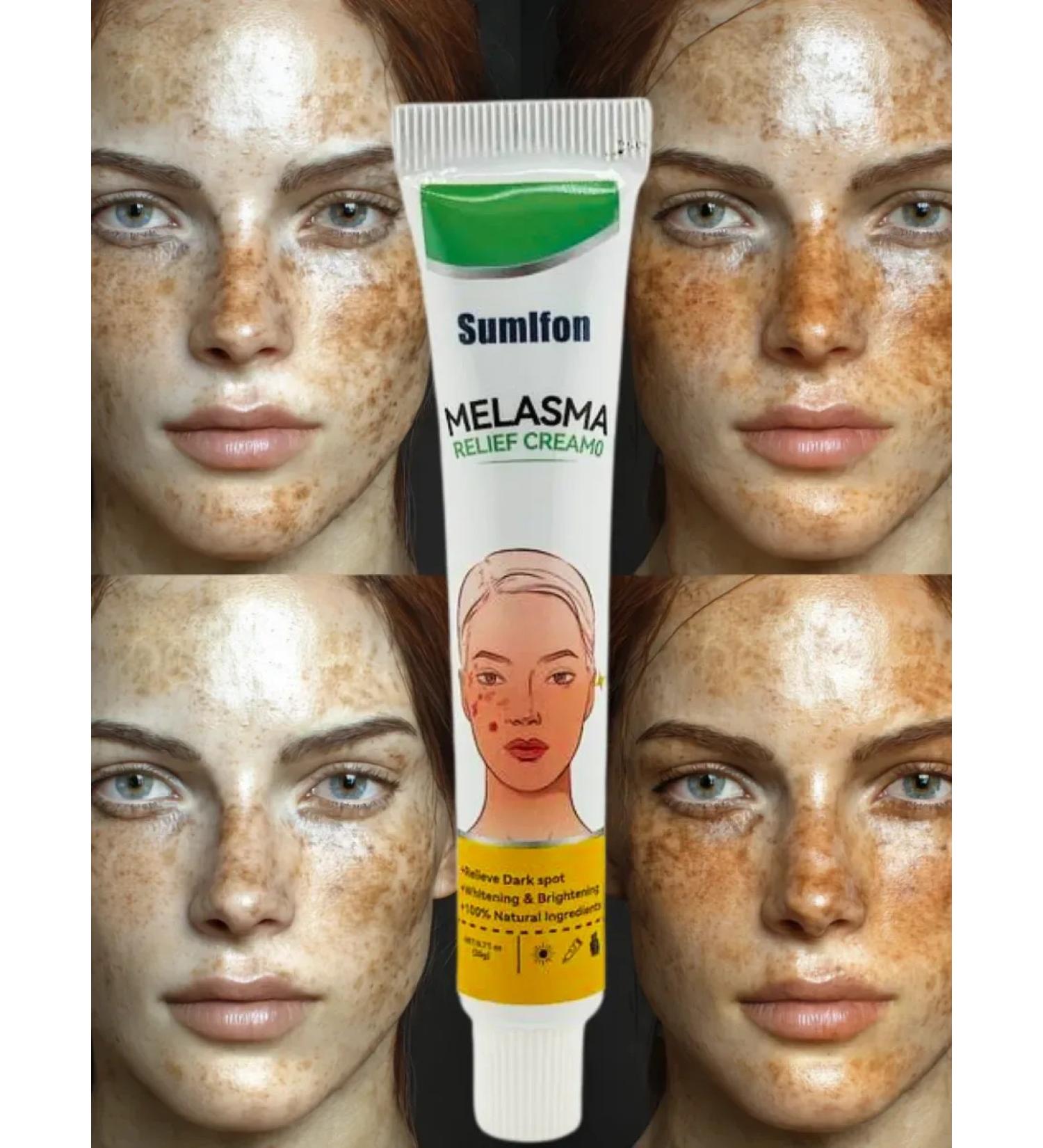 mua Cream from age spots on the face of a healing - Buy Online on GoSupps.com