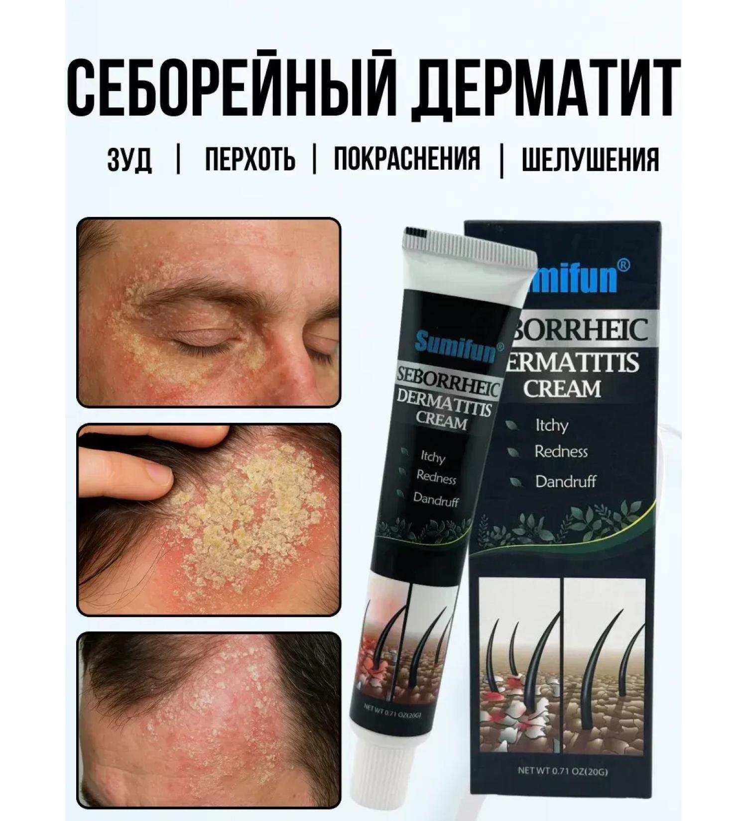 muva Ointment cream for seborrhea - Buy Online on GoSupps.com