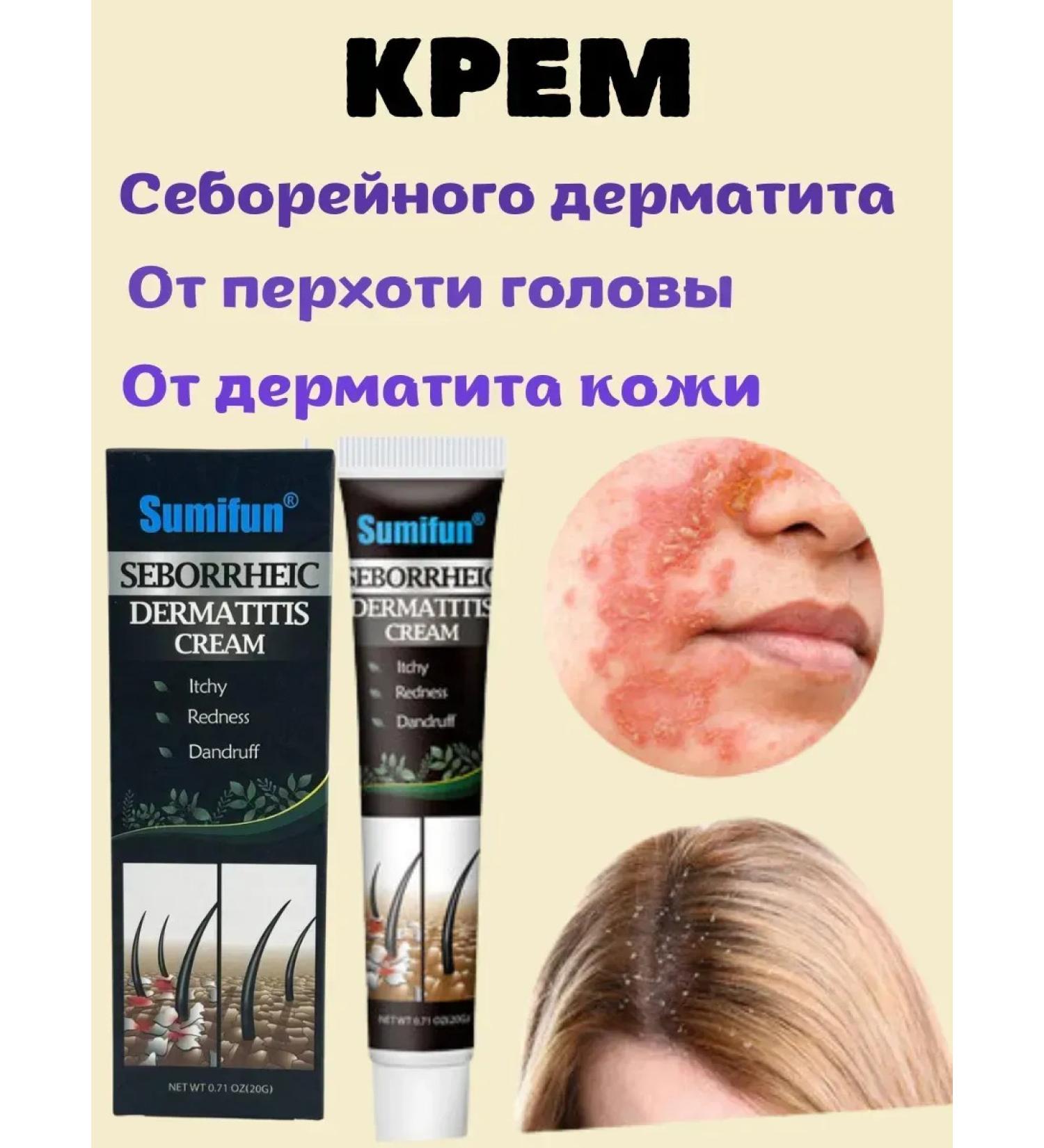 BiuG Cream from seborrheic dermatitis of the head on the face from dandruff - Buy Online on GoSupps.com