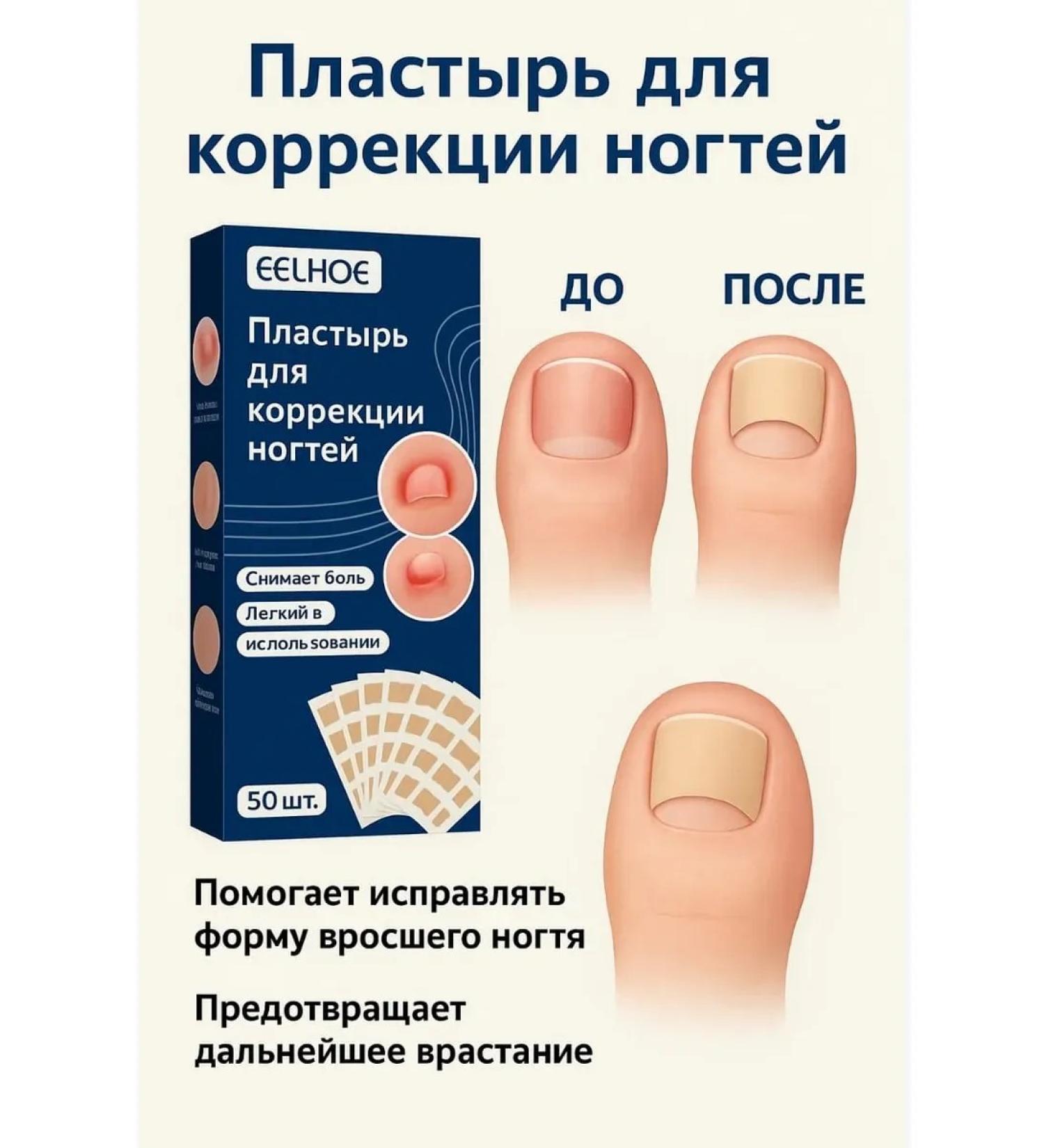 Kubataeva Patch from nail fungus on the legs and an ingrown nail - Buy Online on GoSupps.com