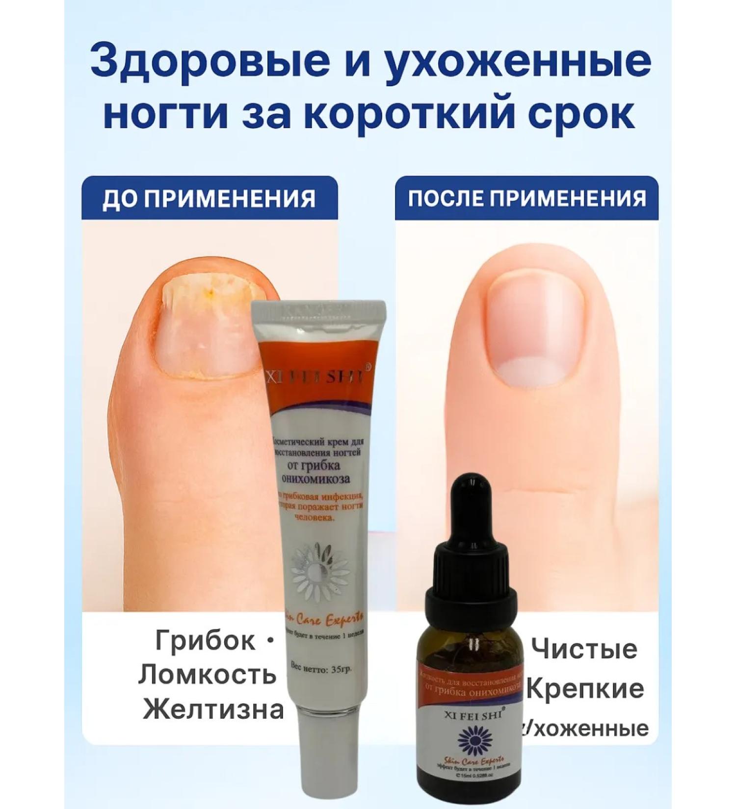 SK42 Cosmetic set for restoration of nails from the fungus - Buy Online on GoSupps.com