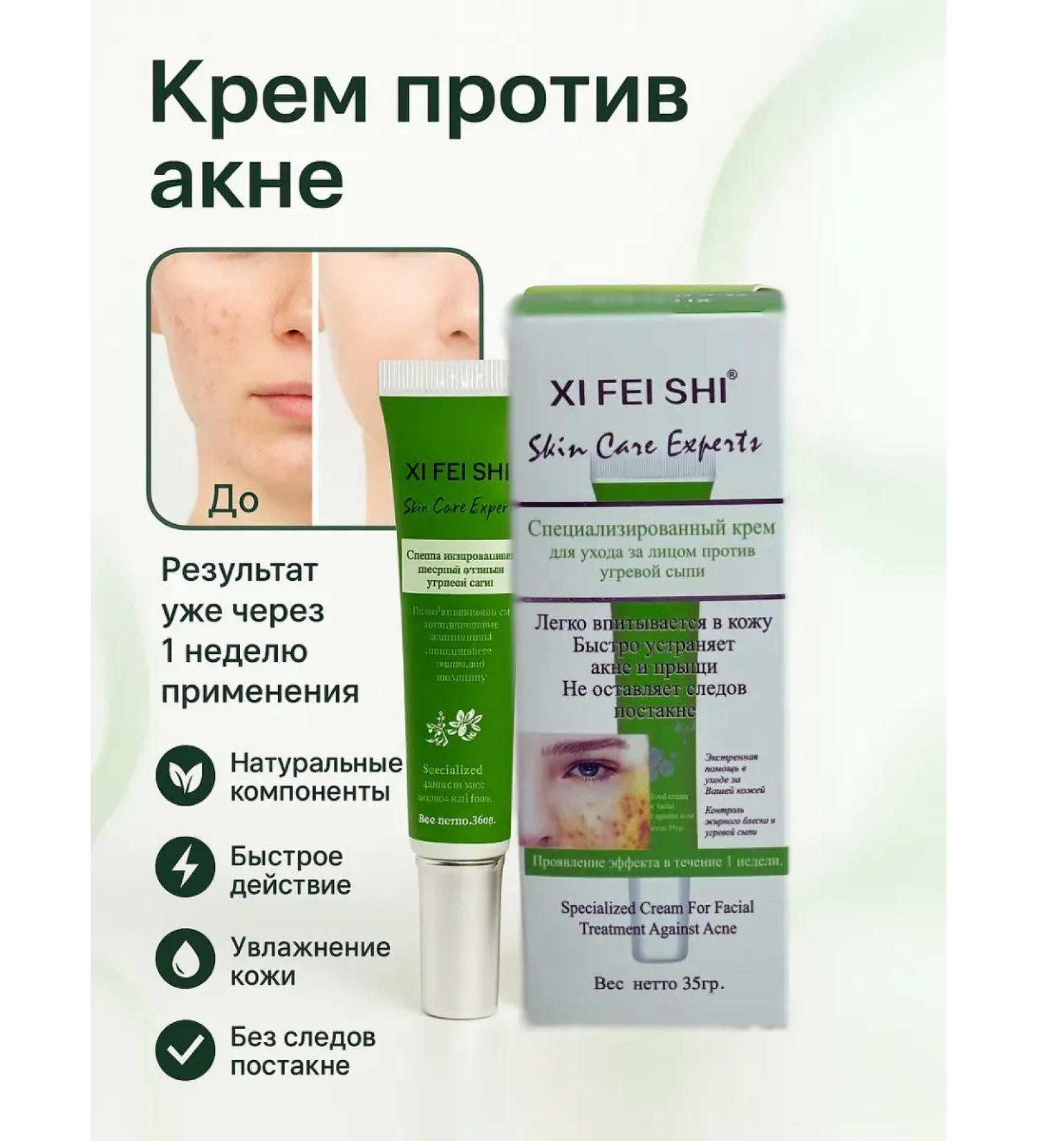 September time Acne and acne cream for adolescents 35 g - Buy Online on GoSupps.com