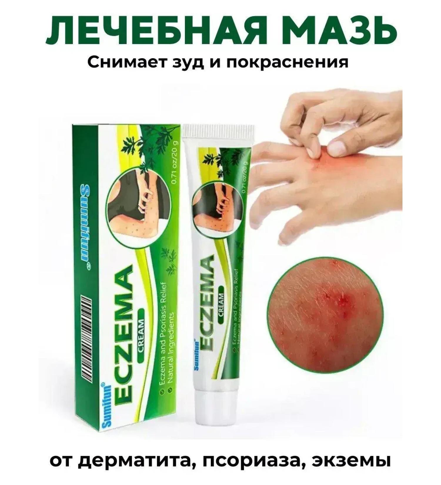 Chinese Simufin creams Eczema and dermatitis cream