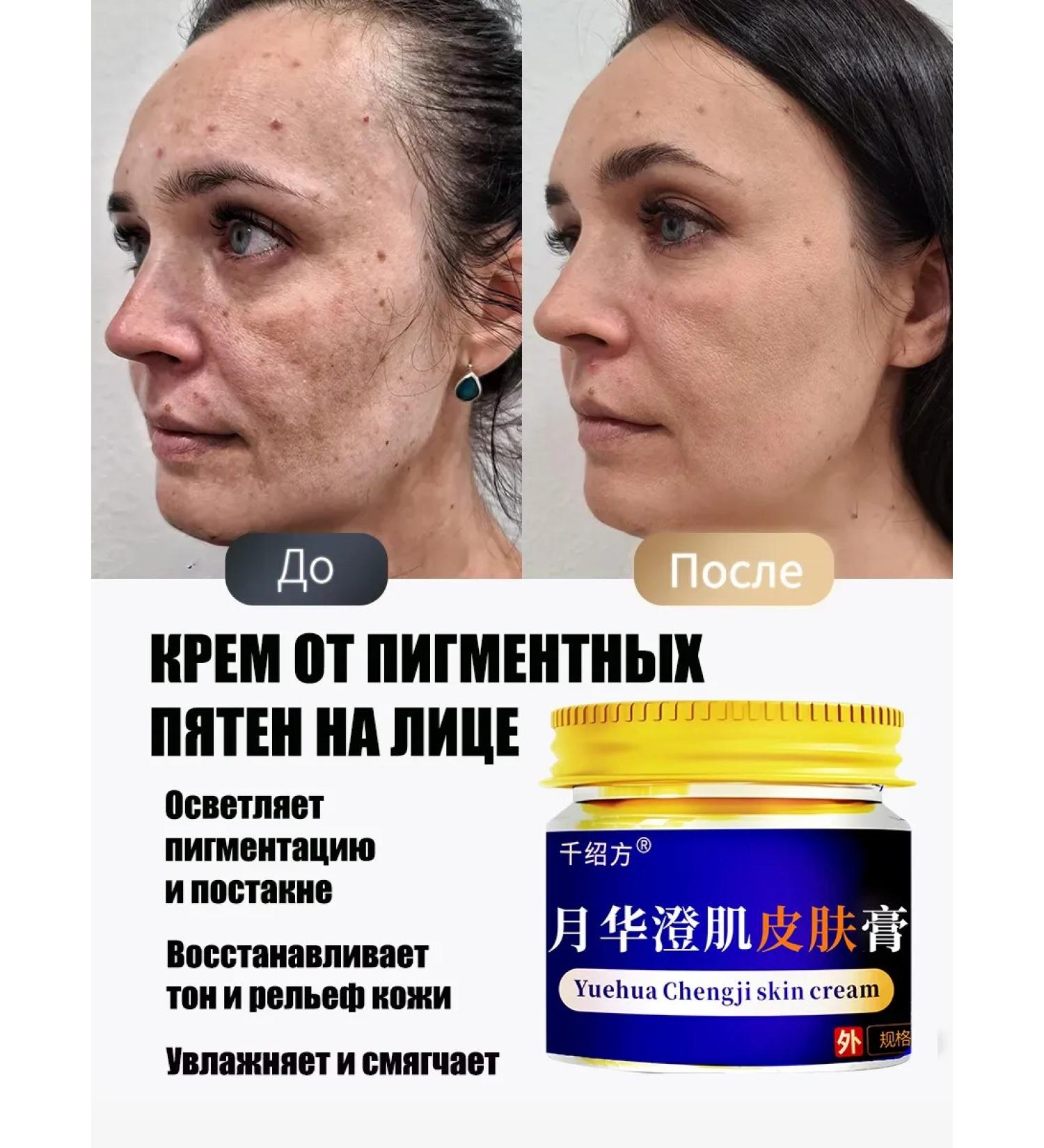 Cream for whitening and removing pigmentation - Buy Online on GoSupps.com