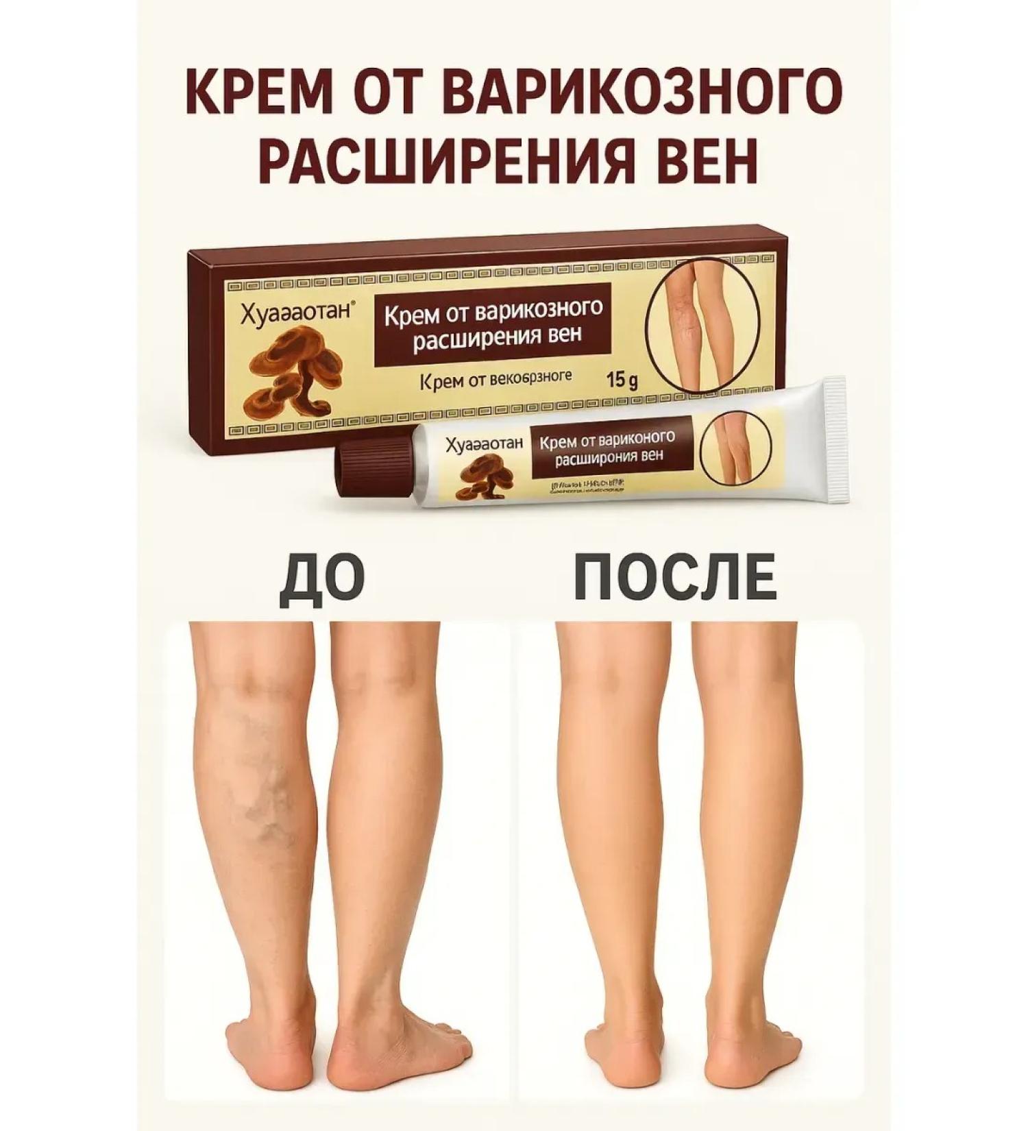 OKEN ointment from varicose veins on the legs of China anti -inflammatory cream - Buy Online on GoSupps.com