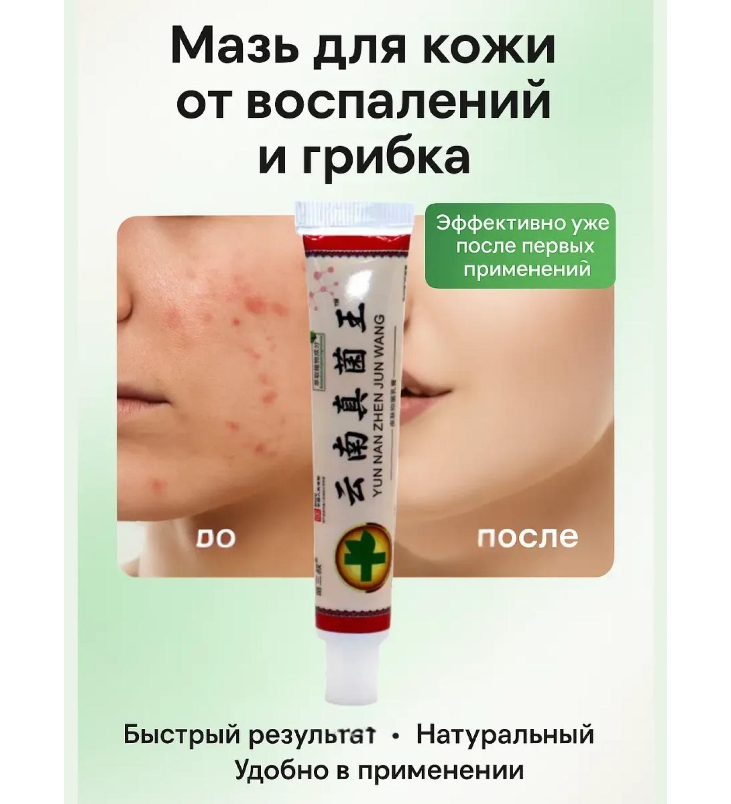 olchik Skin ointment from inflammation and fungus antiseptic cream - Buy Online on GoSupps.com