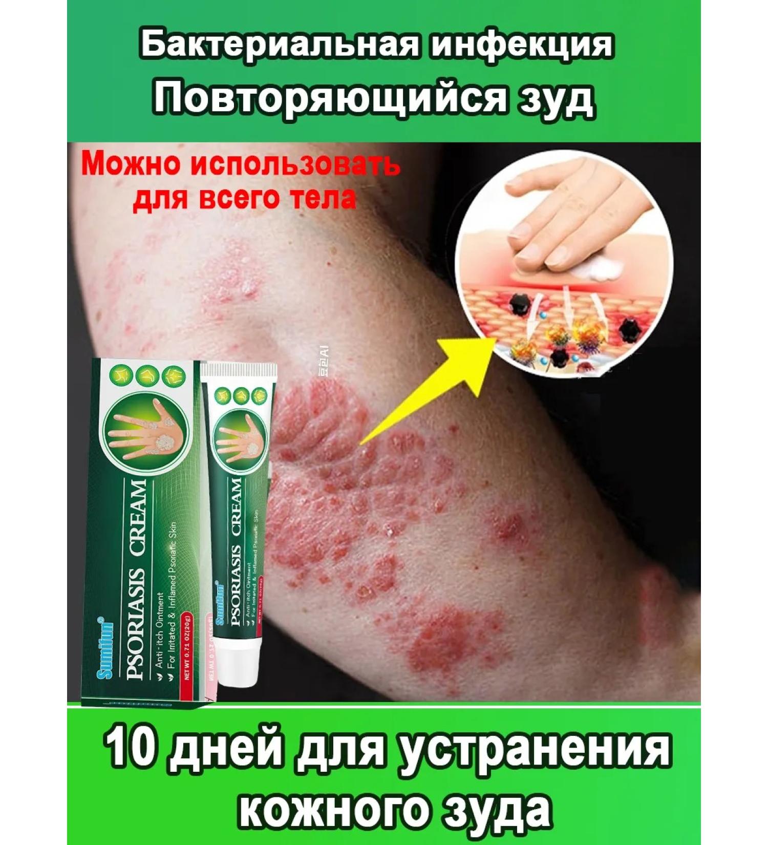 Itching cream is relieved of bacterial infections 20 g - Buy Online on GoSupps.com
