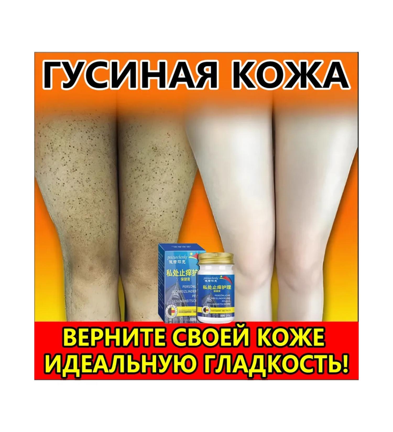 Cream from goose skin on the legs 50 g - Buy Online on GoSupps.com