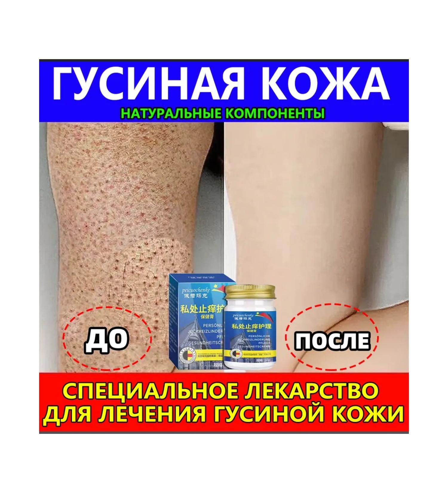 Cream from goose skin for body 100 g - Buy Online on GoSupps.com