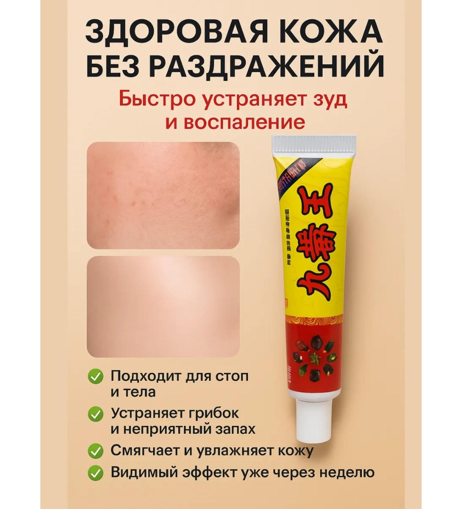 LI4 Cream from fungus and skin irritation for feet and body - Buy Online on GoSupps.com