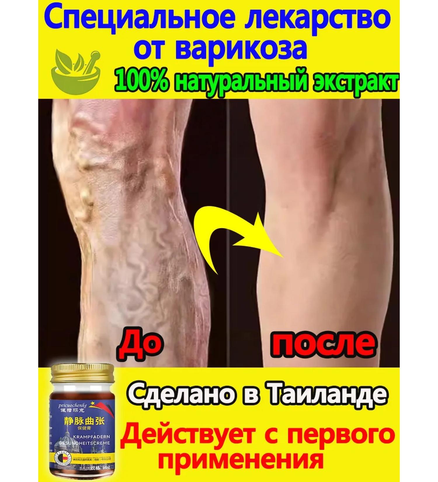 Ointment for the treatment of varicose veins 50 g - Buy Online on GoSupps.com