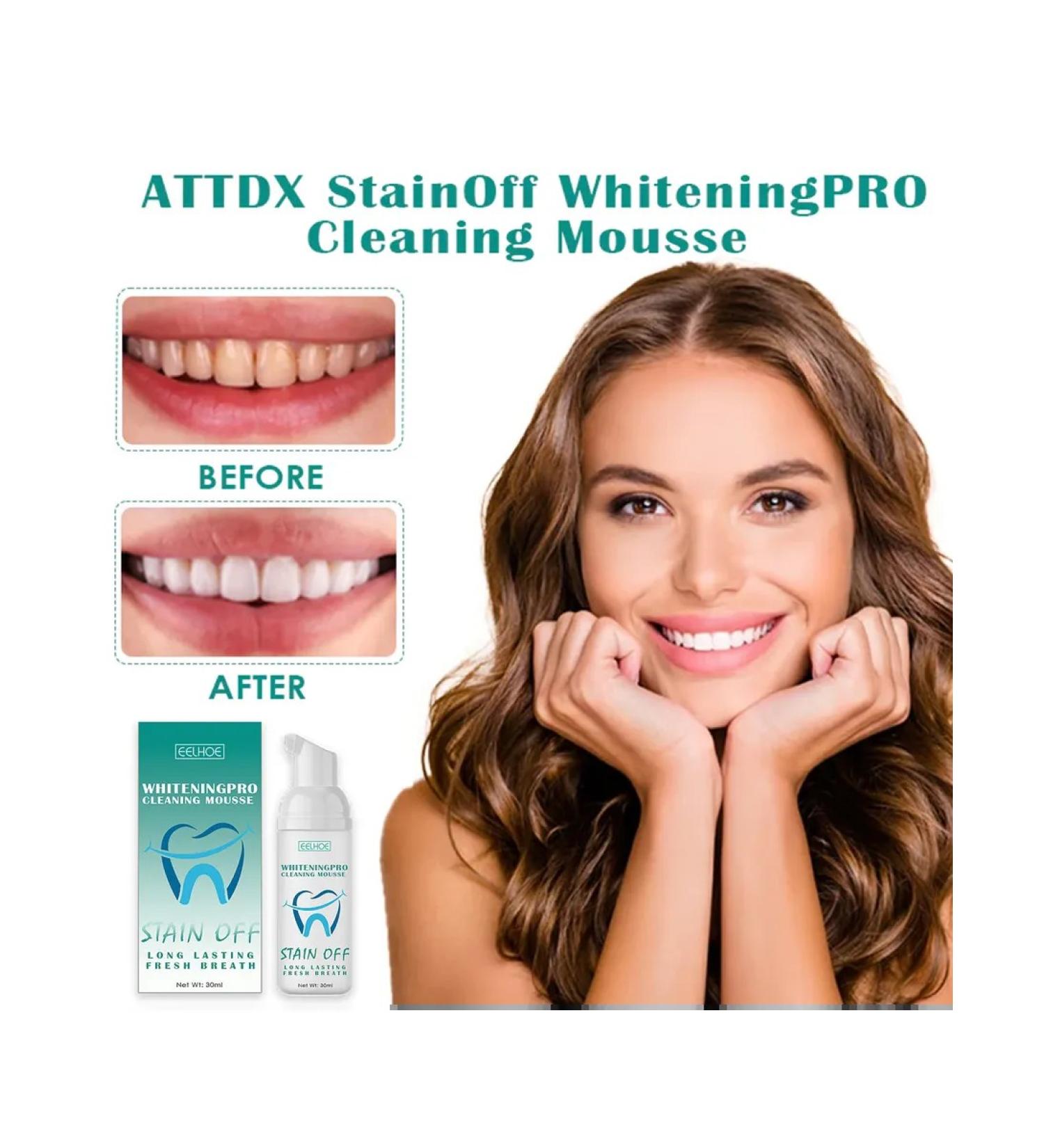 Teeth whitening mousse foam - Buy Online on GoSupps.com