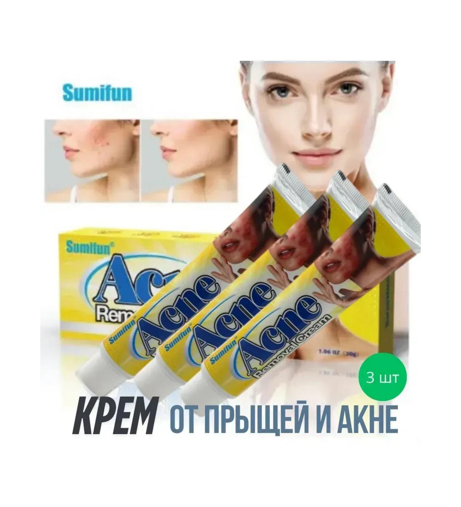 MaxWish 09 Acne and acne antibacterial cream 3pcs - Buy Online on GoSupps.com