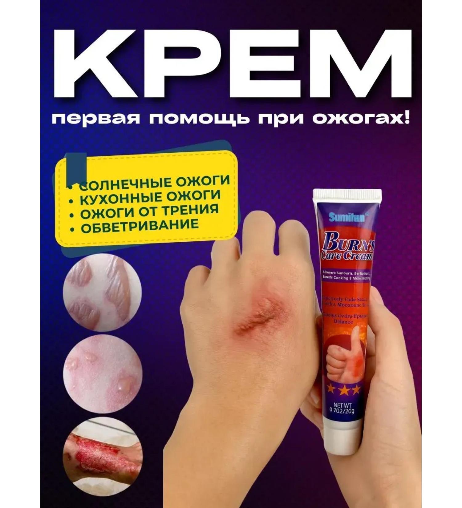 Dona7 Cream for dryness and peeling of the skin after a burn - Buy Online on GoSupps.com